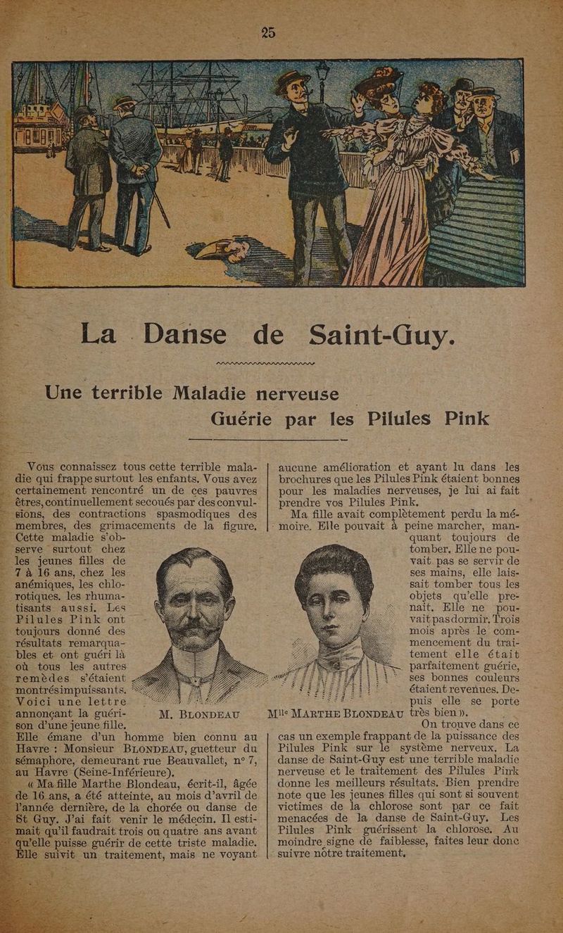 25 pe Vous connaissez tous cette terrible mala- die qui frappe surtout les enfants. Vous avez . certainement rencontré un de ces pauvres êtres, continuellement secoués par des convul- sions, des contractions spasmodiques des membres, des grimacements de la figure, Cette maladie s’ob- serve surtout chez les jeunes filles de 7 à 16 ans, chez les anémiques, les chlo- rotiques. les rhuma- tisants aussi. Les Pilules Pink ont toujours donné des résultats remarqua- - bles et ont guéri là où tous les autres remèdes s'étaient montrésimpuissants. … Voici une lettre . annonçant la guéri- son d’une jeune fille, … Elle émane d’un homme bien connu au * Havre : Monsieur BLONDEAU, guetteur du _sémaphore, demeurant rue Beauvallet, n° 7, au Havre (Seine-Inférieure), | «Ma fille Marthe Blondeau, écrit-il, âgée - de 16 ans, a été atteinte, au mois d’avril de l’année dernière, de la chorée ou danse de = St Guy. J'ai fait venir le médecin. Il esti- -mait qu'il faudrait trois ou quatre ans avant qu'elle puisse guérir de cette triste maladie. - Elle suivit un traitement, mais ne voyant = aucune amélioration et ayant lu dans les brochures que les Pilules Pink étaient bonnes pour les maladies nerveuses, je lui ai fait prendre vos Pilules Pink. Ma fille avait complètement perdu la mé- quant toujours de tomber. Elle ne pou- vait pas se servir de ses mains, elle lais- sait tomber tous les objets qu'elle pre- nait. Elle ne pou- vaitpasdormir. Trois mois après le com- mencement du trai- tement elle était . parfaitement guérie, ses bonnes couleurs iF étaient reveñues. De- EN Le puis elle se porte très bien }. : On trouve dans ce cas un exemple frappant de la puissance des Pilules Pink sur le système nerveux. La danse de Saint-Guy est une terrible maladie nerveuse et le traitement des Pilules Pink donne les meilleurs résultats. ‘Bien prendre note que les jeunes filles qui sont si souvent victimes de la chlorose sont par ce fait menacées de la danse de Saint-Guy. Les Pilules Pink guérissent la chlorose. Au moindre signe de faiblesse, faites leur donc