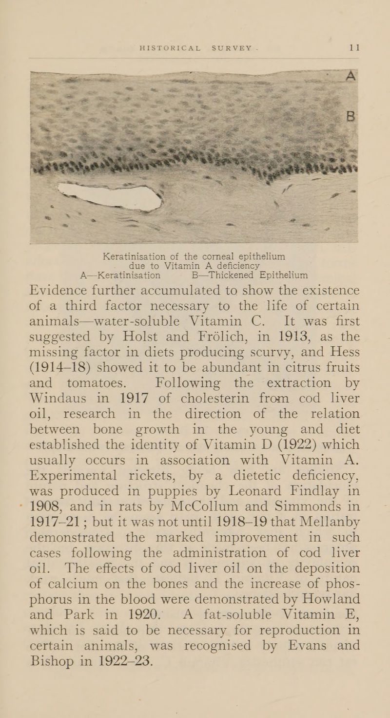 Keratinisation of the corneal epithelium . due to Vitamin A deficiency A—Keratinisation B—Thickened Epithelium Evidence further accumulated to show the existence of a third factor necessary to the life of certain animals—water-soluble Vitamin C. It was first suggested by Holst and Frdélich, in 1913, as the missing factor in diets producing scurvy, and Hess (1914-18) showed it to be abundant in citrus fruits and tomatoes. Following the extraction by Windaus in 1917 of cholesterin from cod liver oil, research in the direction of the relation between bone growth in the young and diet established the identity of Vitamin D (1922) which usually occurs in association with Vitamin A, Experimental rickets, by a dietetic deficiency, was produced in puppies by Leonard Findlay in 1908, and in rats by McCollum and Simmonds in 1917-21; but it was not until 1918-19 that Mellanby demonstrated the marked improvement in such cases following the administration of cod liver oil. The effects of cod liver oil on the deposition of calcium on the bones and the increase of phos- phorus in the blood were demonstrated by Howland and Park in 1920. A fat-soluble Vitamin E, which is said to be necessary for reproduction in certain animals, was recognised by Evans and Bishop in 1922-23.