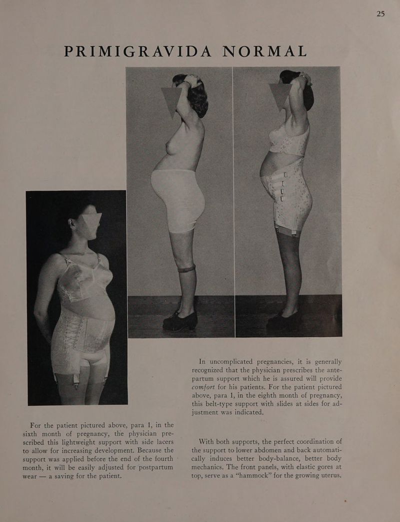 For the patient pictured above, para 1, in the sixth month of pregnancy, the physician pre- scribed this lightweight support with side lacers to allow for increasing development. Because the support was applied before the end of the fourth month, it will be easily adjusted for postpartum wear — a saving for the patient. In uncomplicated pregnancies, it is generally recognized that the physician prescribes the ante- partum support which he is assured will provide comfort for his patients. For the patient pictured above, para 1, in the eighth month of pregnancy, this belt-type support with slides at sides for ad- justment was indicated, With both supports, the perfect coordination of the support to lower abdomen and back automati- cally induces better body-balance, better body mechanics. The front panels, with elastic gores at top, serve as a “hammock” for the growing uterus.