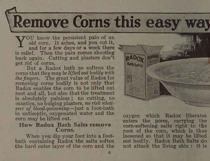 OU know the persistent pain of an old corn. It aches, and you cut it, and for a few days or a week there is relief. Then the pain comes shooting back again. Cutting and plasters don’t get rid of corns. But a Radox bath so softens the corns that they may be lifted out bodily with the fingers. The great value of Radox for removing corns bodily is not only that Radox enables the corn to be lifted out root and all, but also that the treatment is absolutely painless; no cutting, no caustics, no bulging plasters, no risk what- ever of blood-poisoning—just a foot-bath in antiseptic, oxygenated water and the corn may be lifted out. How Radox Bath Salts remove Corns. When you dip your foot into a foot- bath containing Radox the salts soften the hard outer layer of the corn and the