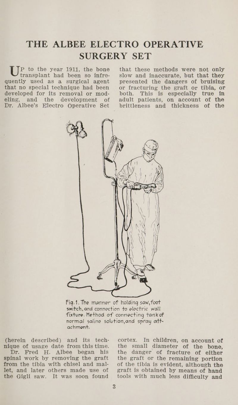 P to the year 1911, the bone transplant had been so infre- quently used as a surgical agent that no special technique had been developed for its removal or mod- eling, and the development of Dr. Albee’s Electro Operative Set et é that these methods were not only slow and inaccurate, but that they presented the dangers of bruising or fracturing the graft or tibia, or both. This is especially true in adult patients, on account of the brittleness and thickness of the ra SEN — = <a = ee on re (Ge, fl a a cas - Ses =e —— —— { . ey achment. (herein described) and its tech- nique of usage date from this time. Dr. Fred H. Albee began his spinal work by removing the graft from the tibia with chisel and mal- let, and later others made use of the Gigli saw. It was soon found cortex. In children, on account of the small diameter of the bone, the danger of fracture of either the graft or the remaining portion of the tibia is evident, although the graft is obtained by means of hand tools with much less difficulty and