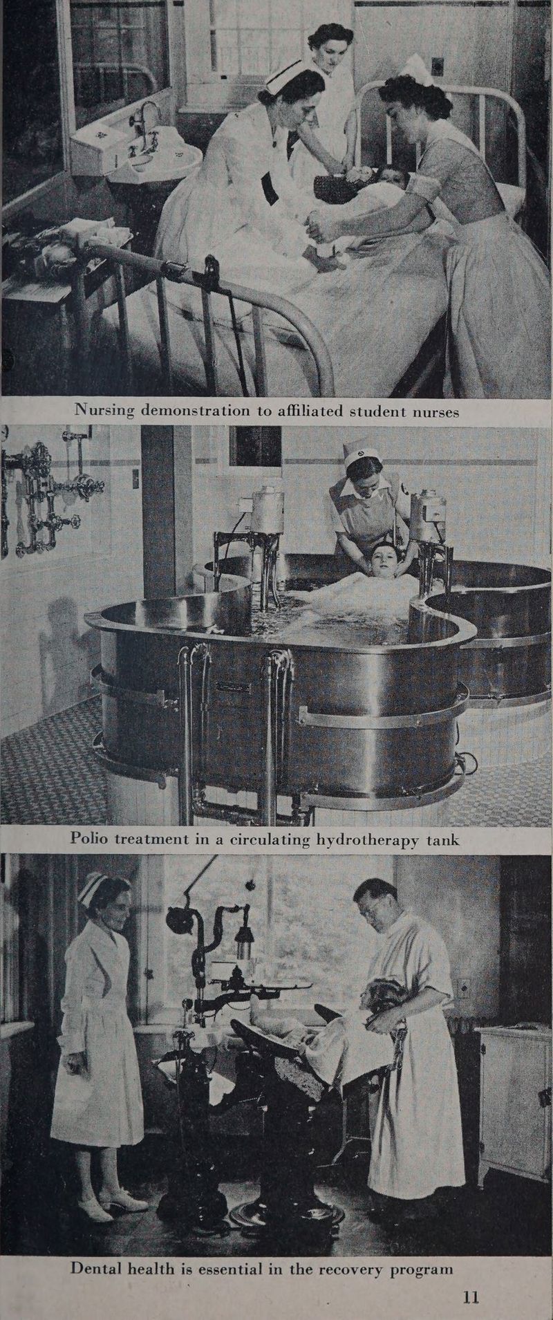 sera strane ing demonstration to affiliate 2 x } Nurs d student nurses Polio treatment in a circulating hydrotherapy tank Dental health is essential in the recovery program , ll