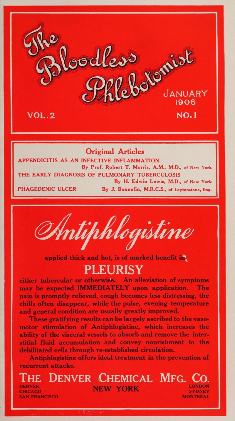 JANUARY i906 NO. 1 Original Articles APPENDICITIS AS AN INFECTIVE INFLAMMATION By Prof. Robert T. Morris, A.M., M.D., of New York THE EARLY DIAGNOSIS OF PULMONARY TUBERCULOSIS | By H. Edwin Lewis, M.D., of New York | PHAGEDENIC ULCER By J. Bonnefin, M.R.C.S., of Leytonstone, Eng. applied thick and hot, is of marked benefit in PLEURISY either tubercular or otherwise. An alleviation of symptoms may be expected IMMEDIATELY upon application. The pain is promptly relieved, cough becomes less distressing, the chills often disappear, while the pulse, evening temperature and general condition are usually greatly improved. These gratifying results can be largely ascribed to the vaso- motor stimulation of Antiphlogistine, which increases the ability of the visceral vessels to absorb and remove the inter- stitial fluid accumulation and convey nourishment to the debilitated cells through re-established circulation. Antiphlogistine offers ideal treatment in the prevention of recurrent attacks. THE DENVER CHEMICAL MEG. Co. iol NEW YORK | peak SAN FRANCISCO MONTREAL