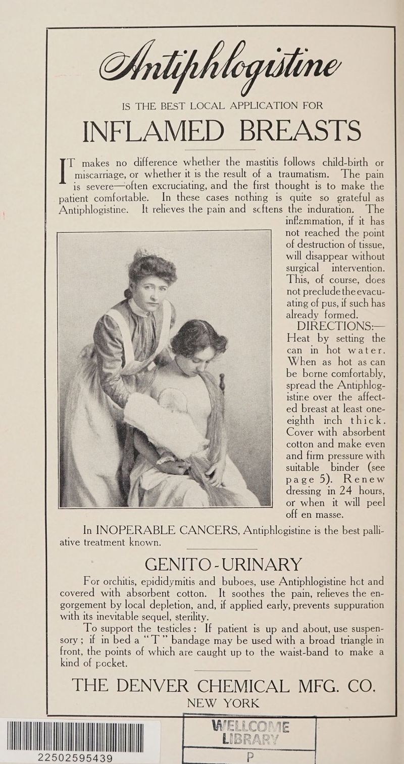 IS THE BEST LOCAL APPLICATION FOR INFLAMED BREASTS T makes no difference whether the mastitis follows child-birth or miscarriage, or whether it is the result of a traumatism. The pain is severe—often excruciating, and the first thought is to make the patient comfortable. In these cases nothing is quite so grateful as Antiphlogistine. It relieves the pain and scftens the induration. The in temmation, if it has not reached the point of destruction of tissue, will disappear without surgical intervention. This, of course, does not preclude the evacu- ating of pus, if such has already formed. DIRECTIONS:— Heat by setting the can in hot water. When as hot as can be borne comfortably, spread the Antiphlog- istine over the affect- ed breast at least one- eighth inch thick. Cover with absorbent cotton and make even and firm pressure with suitable binder (see page 5). Renew dressing in 24 hours, or when it will peel off en masse. In INOPERABLE CANCERS, Antiphlogistine is the best palli- ative treatment known. GENITO-URINARY For orchitis, epididymitis and buboes, use Antiphlogistine hot and covered with absorbent cotton. It soothes the pain, relieves the en- gorgement by local depletion, and, if applied early, prevents suppuration with its inevitable sequel, sterility. To support the testicles: If patient is up and about, use suspen- sory; if in bed a “IT” bandage may be used with a broad triangle in front, the points of which are caught up to the waist-band to make a kind of pocket. THE DENVER) CHEMICALS ViEGe Ge) NEW YORK 2595439 ee