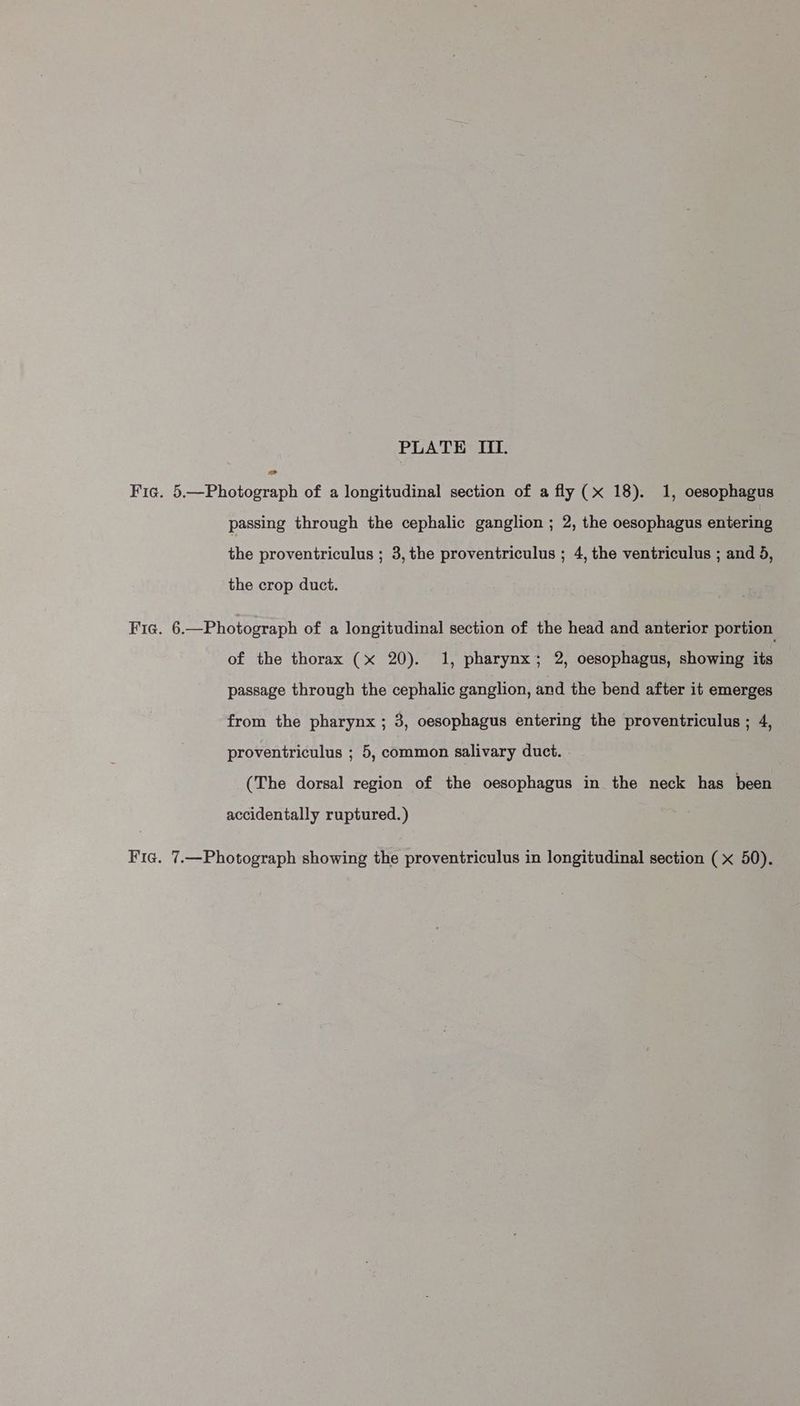 Fic. 5.—Photograph of a longitudinal section of a fly (x 18). 1, oesophagus passing through the cephalic ganglion ; 2, the oesophagus entering the proventriculus ; 3, the proventriculus ; 4, the ventriculus ; and 5, the crop duct. Fie. 6.—Photograph of a longitudinal section of the head and anterior portion of the thorax (x 20). 1, pharynx; 2, oesophagus, showing its passage through the cephalic ganglion, and the bend after it emerges from the pharynx ; 3, oesophagus entering the proventriculus ; 4, proventriculus ; 5, common salivary duct. | (The dorsal region of the oesophagus in the neck has been accidentally ruptured.) Fie. 7.—Photograph showing the proventriculus in longitudinal section ( x 50).