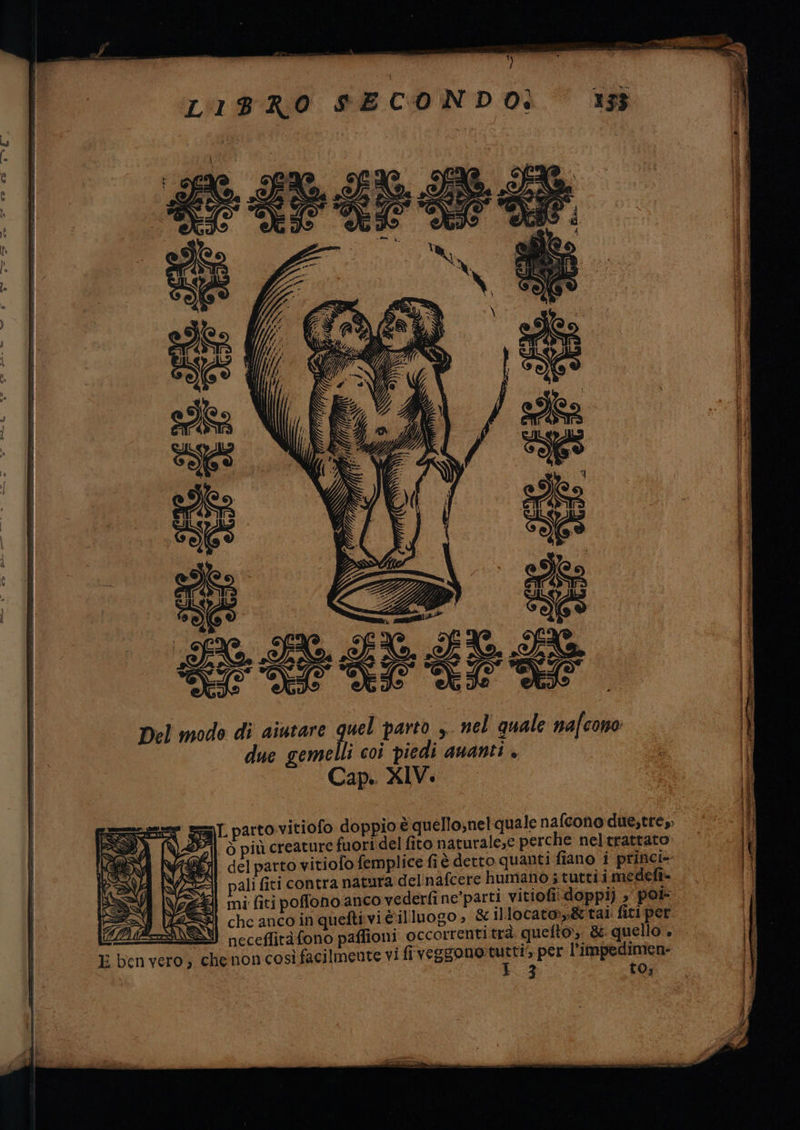 j LIBRO SECONDO: 1353 » É È i si r | È A É i - È (È O i ! i bi i | I o ij | Dia i Î } | Del modo di aiutare quel parto , nel quale nafcono li ls; due gemelli coi piedi AUANLI + Il I ii =L parto vitiofo doppio è quello,nel quale nafcono due,tre, If 2| ò più creature fuori del fito naturale,e perche neltrattato: Il 3 del parto vitiolo femplice fi è detto quanti fiano i ida | pali fiti contra natura delinafcere humano ; tutti i medelt- 24 mi fiti poffono anco vederli ne'parti vitiofi-doppi) È poi î i che ancoinqueftivièilluogo » &amp; illocato»,&amp;tai fici per Î UEZZINNA neceffitàfono paflioni occorrentitrà. quelto),. &amp;. quello. {