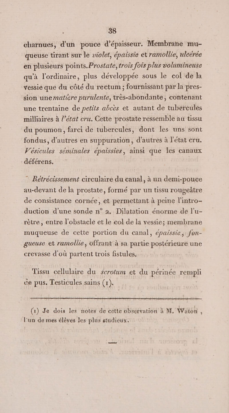 charnues, d’un pouce d’épaisseur. Membrane mu- queuse tirant sur le violet, épaissie et ramollie, ulcérée en plusieurs points. Prostate, troïs fois plus volumineuse qu'à l'ordinaire, plus développée sous le col de la vessié que du côté du rectum ; fournissant par la pres- sion unenatiere purulente, très-abondante, contenant une trentaine de petits abcès et autant de tubérculés milliaires à l’état cru. Cette prostate ressemble au tissu du poumon, farci de tubercules, dont les uns sont fondus, d’autres en suppuration, d'autres à l'état cru. Vésicules séminales épaissies, ainsi que les canaux déférens. | Rétrécissement circulaire du canal, à un demi-pouce au-devant de la prostate, formé par un tissu rougeñtre de consistance cornée, et permettant à peine l’intro- duction d’une sonde n° 2. Dilatation énorme de l’u- rètre , entre l'obstacle et le col de la vessie; membrane muqueuse de cette portion du canal, eépaissie,: fon- gueuse et ramollie, offrant à sa partie postérieure une crevasse d'où partent trois fistules. Tissu cellulaire du scrotum et du périnée rep ue pus. Testicules sains (1). (1) Je dois les notes de cette obsérvation à M. Wäion , l'un de mes élèves les plus studicux.