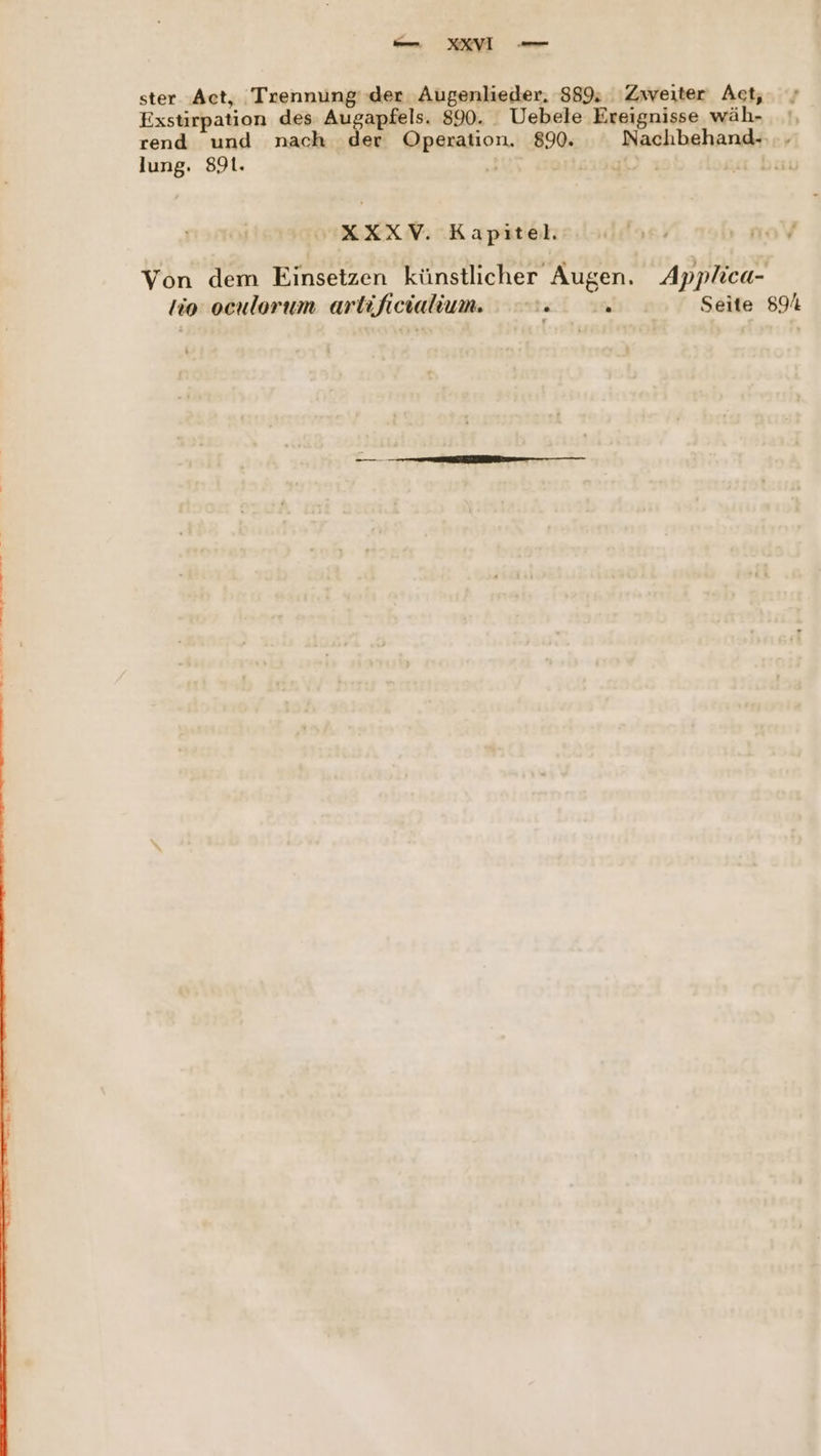 — KRVI ster Act, Trennung‘ -der Augenlieder. 889: Zweiter Act, Exstirpation des Are DeiR 890. . Uebele Ereignisse wäh- |, rend und nach der Operation. 890. Nachbehand.-... lung. 891. # a0) ı bai XXXV. Kapitel. Von dem Einsetzen künstlicher Augen. Applica- tio ocnlorum artificialium. \ ; Seite 89%