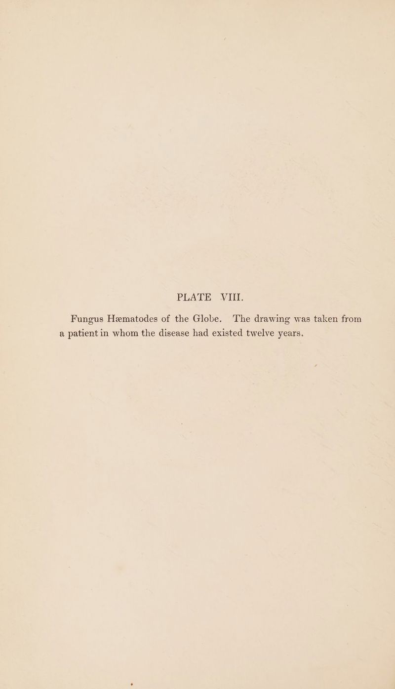 Fungus Hematodes of the Globe. The drawing was taken from a patient in whom the disease had existed twelve years.