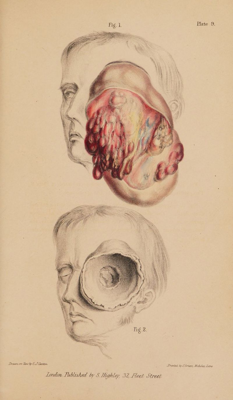 Drawn ory lire by CS Carton Lrinied. by J Griepe, Nichulas Lane