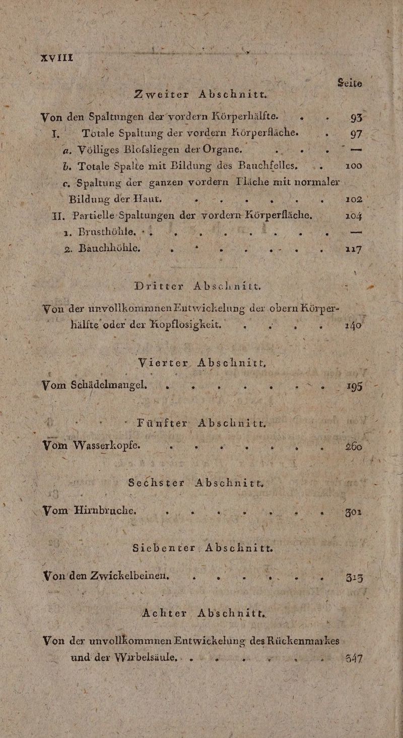 “ Kyilt © A eg | ; | u / Seite Zweiter Abschnitt. Von den Spaltungen der'vordern Rörperhälfte, EEE SSRRT © L. Totale Spaltung der vordern Körperfläche. War: 2. Völliges Blofsliegen der Organe. N % _ b. Totale Spalte mit Bildung des Bauchfelles, .. 100 ce Spaltung der ganzen vordern Tläche mit normaler Bildung der Haut. „.-,.... f : r 102 ar Partielle-Spaltungen der BUT BEN 104 1. Brusthöhle, +, .. k s RR RT — 2. Bauchhöhle. dee Sy 117 * Dritter Abschnitt. ( Von der unvollkommnen Entwichelung der obern Körper- hälfte oder der Hopflosigkeit. BE a Vierter Abschnitt, wu Vom Wasserkopte. re er. e Sechster Abschnitt Fr an ge A| x Siebenter Abschnitt. Von den Zwickelbeinen. . A = Alan A Meoliter Abschnitt, k Von der unvollkommnen Entwickelung des Rückenmarkes und der Wirbelsäule... . ; ö ir SE nn