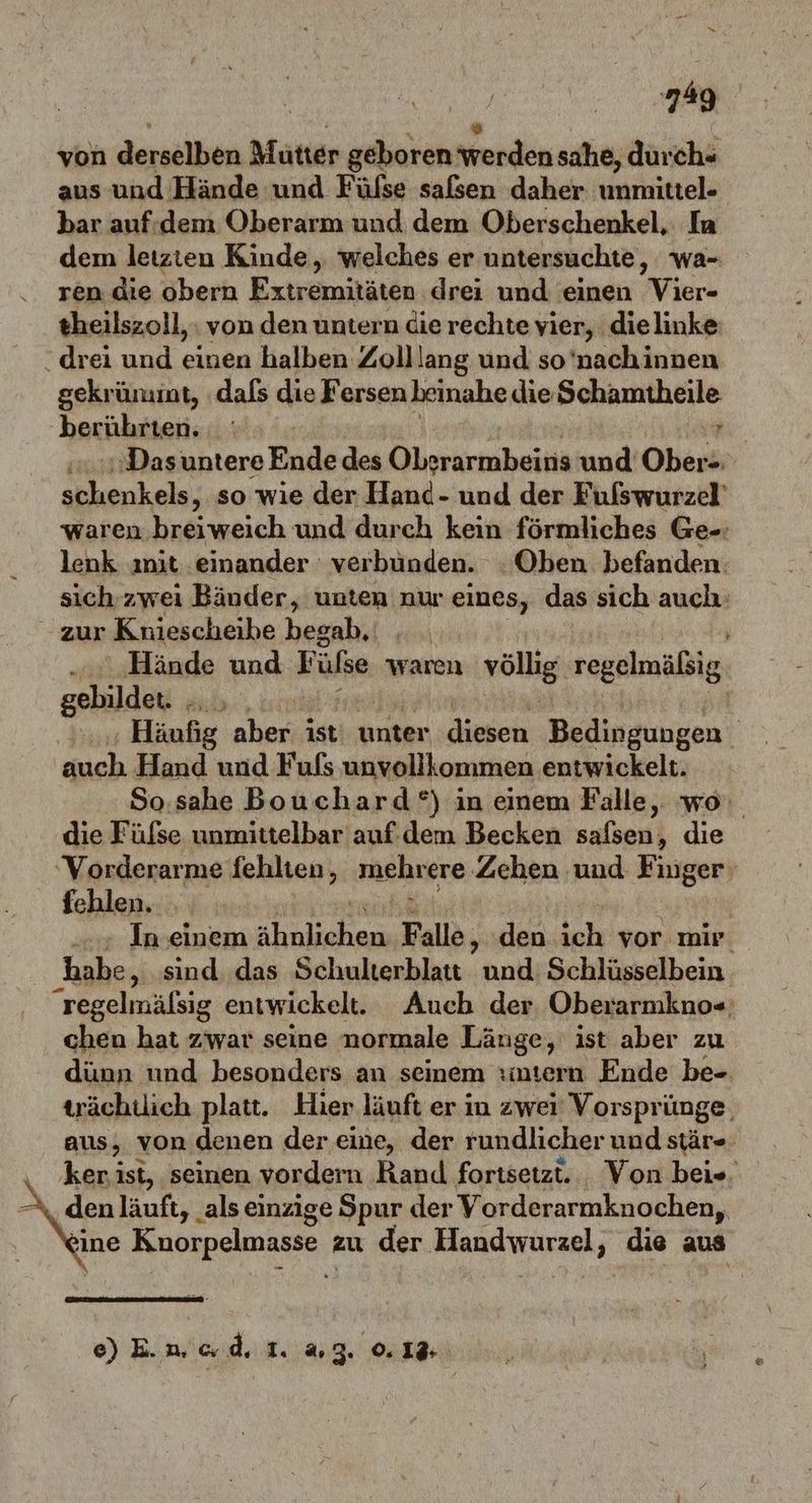 | N von derselben Mutter geboren werden sahe, durch« aus und Hände und Fülse saßen daher unmittel- bar auf-dem Oberarm und dem Oberschenkel, Ia dem letzten Kinde, welches er untersuchte, wa- ren die obern Extremitäten drei und einen Vier- theilszoll, von den untern die rechte yier, dielinke: drei und einen halben Zolllang und so'nachinnen gekrünnt, «dafs die Fersen beinahe die Behauitheile berührten. : Das untere Ende des Olkrarmibesie und Obers schenkels, so wie der Hand- und der Fulswurzel' waren.breiweich und durch kein förmliches Ge-: lenk ınit einander verbunden. . Oben befanden. sich-zwei Bänder, unten nur eines, das sich auch: - zur Kniescheibe begab, ... Hände und F ülse waren völlig regelmäßig gebildet. ii, Häufig aber ist: unter diesen Bedingungen | ha Hand und Fuls unvollkommen entwickelt. So:sahe Bouchard°) in einem Falle,. wo die Füfse unmittelbar auf. dem Becken saßsen, die ‘Vorderarme fehlten, mehrere Zehen und Finger‘ fehlen. N: + In einem ahnliche Falle, den ich vor mir. habe, sind das Schulterblatt und: Schlüsselbein regelmälsig entwickelt. Auch der, Oberarmkno«: chen hat zwar seine normale Länge, ist aber zu dünn und besonders an seinem ıntern Ende be- tächtlich platt. Hier läuft er in zwei Vorsprünge, aus, von denen der eine, der rundlicher und stär«. ker ist, seinen vordern Rand fortsetzt. Von bei«. A denläuft, als einzige Spur der Vorderarmknochen, eine Kunorpelmasse zu der. Handwärael ; Mi aus e) E.n, c.d, I. % 3. | 0, 13-