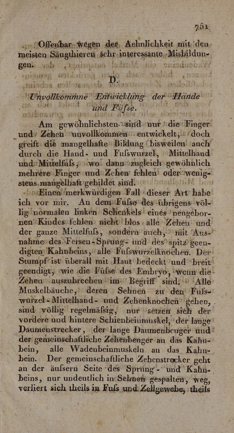 nör Offenbar. wegen det, Achnlichkeit miit.'den, ii K, ? RER p ; gen. hi . 4.1143 KEANE AM ALGAF Ent SHEIIAURN KH f we a ” \ 4 z i BR a BAM a / 8 vr 4 FT » 4 ae . Van A RER RNT 9 #’ [} . „a mindoe EI RE TORE BER IE 5 Men RED RS I NEON N Unpollkom MIDERINIG TIERE in Alma Nil m sewöhnlichsten.“ sind nur die! Finger und’ Zehen‘ unvollkommen‘“: entwickelt;.: “doch EUREN, a Race TEIPTIEITER | mne' Ent: rieklung der 'Hrande‘ 7. 0%0 Tr Erik at durch die Hand- und Fulswurzel, : Mittelhaud _ undirMittelfüls ; wo. danu:özugleich’ gewöhnlich mehrere Finger und“ Zehen fehlen‘ oderwenig- stens. mangelhaft gebildet sind. asklerui MM hi -ı» Einen /merkwürdigen Fall’dieser Art’habe ich vor mir. An demiFufsedes“übrigens völ- lig'normalen linken Schenkels' eines ’nengebor- 'nen''Kindes: fehlen: nicht! blos : alle ‚Zehen: und id ‘ würzel-Mittelhand- und Zehenknocheü’ gehen, smd völlig regelmäfsig, nur setzen sich der ‚Däumenstrecker, der lange Daumenbeuger und ey EIN «| nn PEN f ' „e der genieinschaftliche Zehenbeuger an das Kahn- bein. Der gemeinschaftliche Zehenstrecker geht beins, nur undeutlich in Sehnen gespalten‘, weg, verliert sich theils in Eußs und: Zeligewebe; :theils