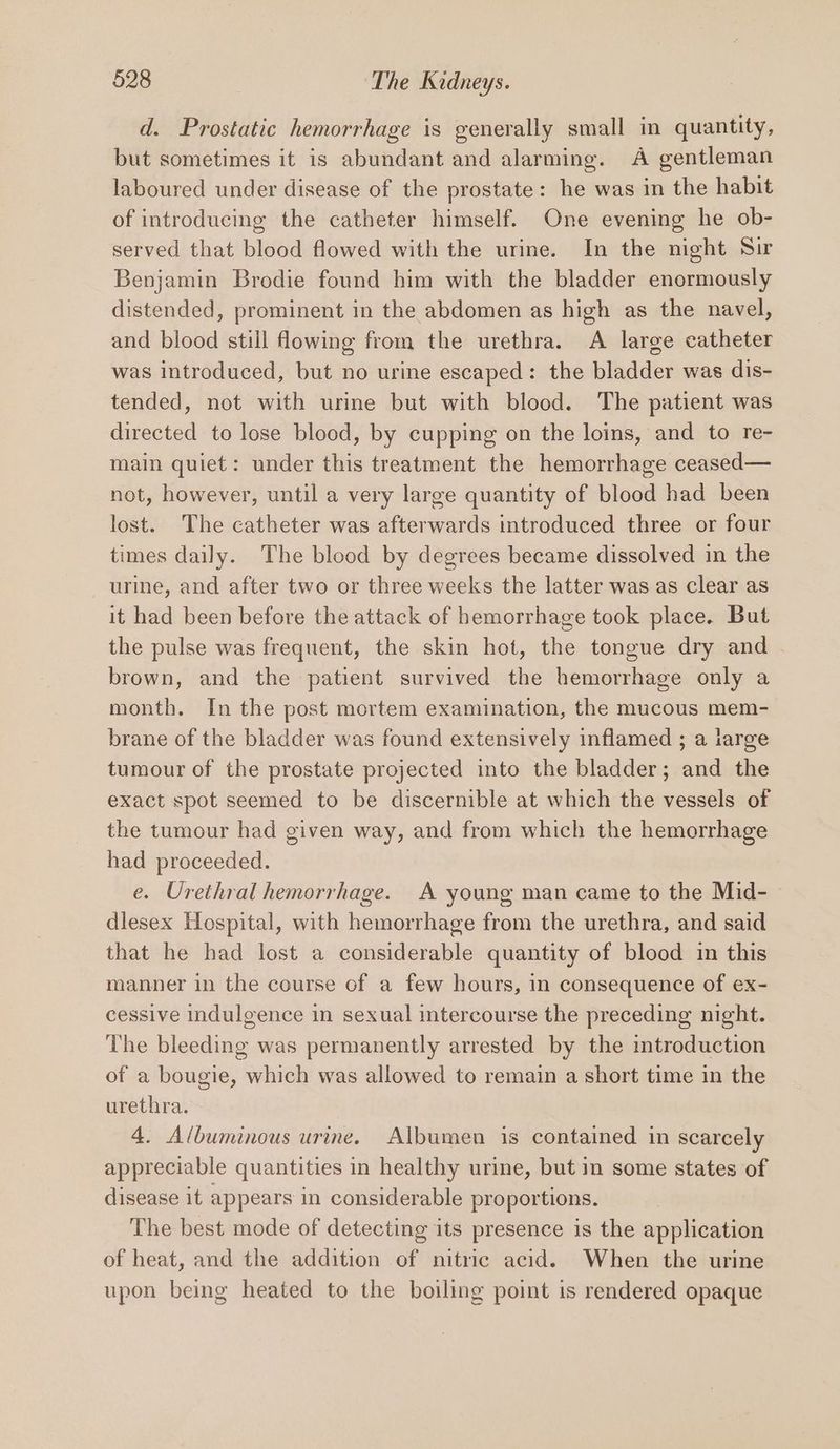 d. Prostatic hemorrhage is generally small in quantity, but sometimes it is abundant and alarming. A gentleman laboured under disease of the prostate: he was in the habit of introducing the catheter himself. One evening he ob- served that blood flowed with the urine. In the night Sir Benjamin Brodie found him with the bladder enormously distended, prominent in the abdomen as high as the navel, and blood still flowing from the urethra. A large catheter was introduced, but no urine escaped: the bladder was dis- tended, not with urine but with blood. The patient was directed to lose blood, by cupping on the loins, and to re- main quiet: under this treatment the hemorrhage ceased— not, however, until a very large quantity of blood had been lost. The catheter was afterwards introduced three or four times daily. The blood by degrees became dissolved in the urine, and after two or three weeks the latter was as clear as it had been before the attack of hemorrhage took place. But the pulse was frequent, the skin hot, the tongue dry and brown, and the patient survived the hemorrhage only a month. In the post mortem examination, the mucous mem- brane of the bladder was found extensively inflamed ; a large tumour of the prostate projected into the bladder; and the exact spot seemed to be discernible at which the vessels of the tumour had given way, and from which the hemorrhage had proceeded. e. Urethral hemorrhage. A young man came to the Mid- dlesex Hospital, with hemorrhage from the urethra, and said that he had lost a considerable quantity of blood in this manner in the course of a few hours, in consequence of ex- cessive indulgence in sexual intercourse the preceding night. The bleeding was permanently arrested by the introduction of a bougie, which was allowed to remain a short time in the urethra. 4. Albuminous urine. Albumen is contained in scarcely appreciable quantities in healthy urine, but in some states of disease it appears in considerable proportions. The best mode of detecting its presence is the application of heat, and the addition of nitric acid. When the urine upon being heated to the boiling point is rendered opaque