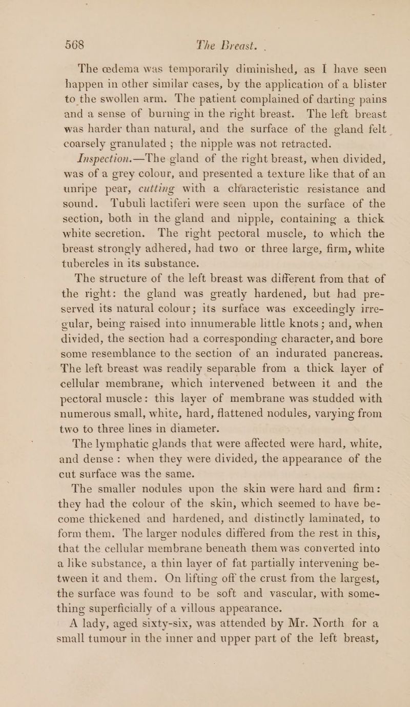 The cedema was temporarily diminished, as I have seen happen in other similar cases, by the application of a blister to the swollen arm. The patient complained of darting pains and a sense of burning in the right breast. The left breast was harder than natural, and the surface of the gland felt_ coarsely granulated ; the nipple was not retracted. Inspection.—The gland of the right breast, when divided, was of a grey colour, and presented a texture like that of an unripe pear, cutting with a characteristic resistance and sound. Tubuli lactiferi were seen upon the surface of the section, both in the gland and nipple, containing a thick white secretion. The right pectoral muscle, to which the breast strongly adhered, had two or three large, firm, white tubercles in its substance. The structure of the left breast was different from that of the right: the gland was greatly hardened, but had pre- served its natural colour; its surface was exceedingly irre- cular, being raised into innumerable little knots ; and, when divided, the section had a corresponding character, and bore some resemblance to the section of an indurated pancreas. The left breast was readily separable from a thick layer of cellular membrane, which intervened between it and the pectoral muscle: this layer of membrane was studded with numerous small, white, hard, flattened nodules, varying from two to three lines in diameter. The lymphatic glands that were affected were hard, white, and dense : when they were divided, the appearance of the cut surface was the same. : The smaller nodules upon the skin were hard and firm: they had the colour of the skin, which seemed to have be- come thickened and hardened, and distinctly laminated, to form them. The larger nodules differed from the rest in this, that the cellular membrane beneath them was converted into a like substance, a thin layer of fat partially intervening be- tween it and them. On lifting off the crust from the largest, the surface was found to be soft and vascular, with some~ thing superficially of a villous appearance. A lady, aged sixty-six, was attended by Mr. North for a small tumour in the inner and upper part of the left breast,