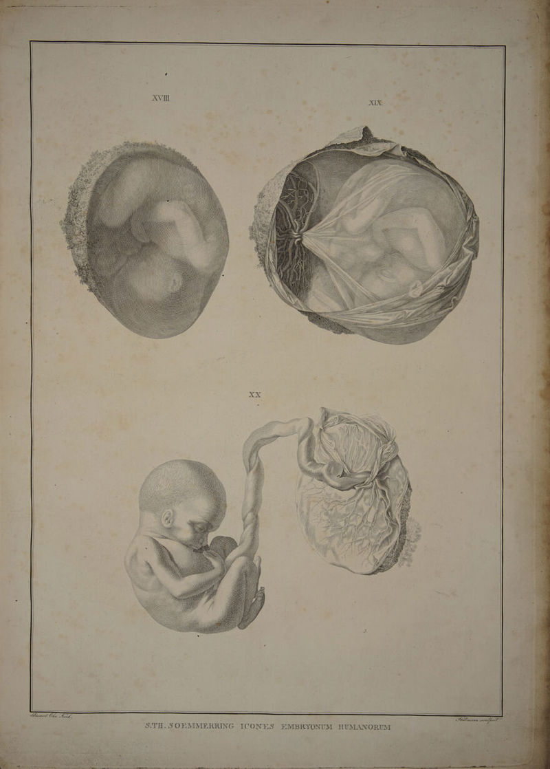 Y W W M N WW M y S.TH.SOEMMERRING ICONES XMBRYONUM HUMANORUM Y M y N N N o   | li ll | Wi J ! WW NW l M W | M ( h