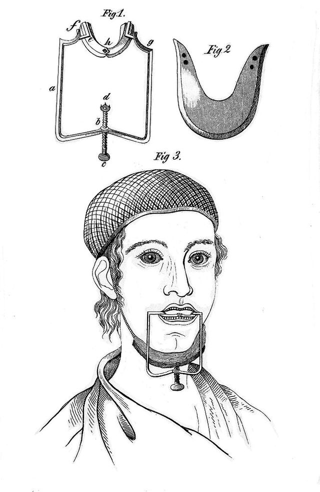 No text description is available for this image