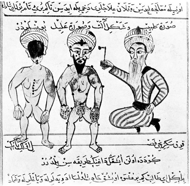 No text description is available for this image