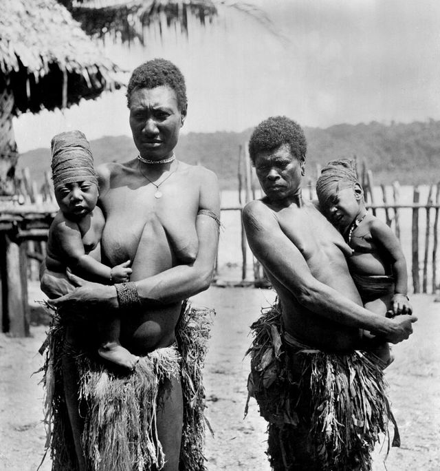 No text description is available for this image