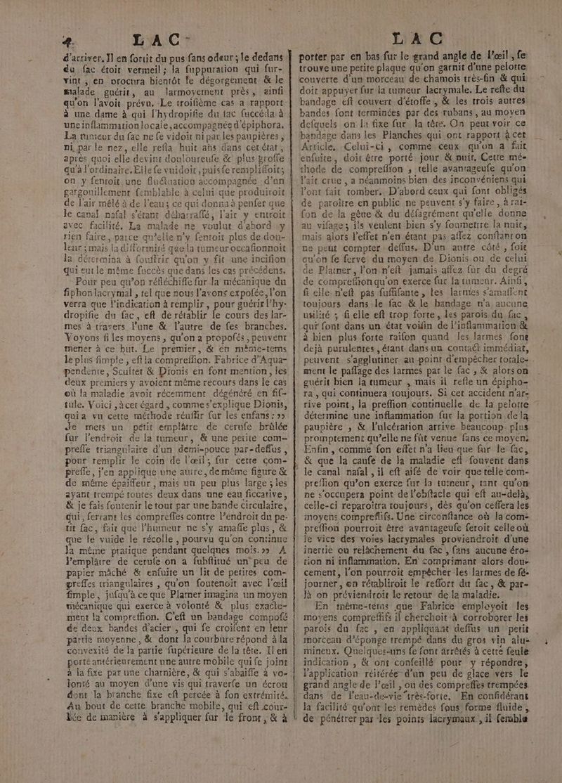 4. LAC: d'arriver, Ïl en fortit du pus fans odeur ; le dedans du fac étoir vermeil; la fuppuration qui fur- vint, en orocura bientôt le dégorgement &amp; le salade guérit, au larmoyement près, ainfi qu'on l'avoit prévu. -Le troifième cas a rapport: à une dame à qui l'hydropifie du tac fuccédai à uneinflammationlocaie,accompagnée d'épiphora. La rumeur du fac ne fe vidoit ni par les paupières , pi par le nez, elle refla huit ahs dans cerétat, après quoi elle devint douloureufe &amp; plus groffe qu'a l'ordinaire. Elle fe vnidoir ,puisfe remplioit; on y fenroit une fluétuation accompagnée d’un gargouillement femblable à celui que produiroit de l'air mèlé à de l'eau; ce qui donna à penfer que le canal nafal s'étant débarraflé, l'air y entroit avec facilité. La malade ne voulut d'abord y rien faire, patce qu’elle n'y fenroit plus de dou- leur ; mais la d'formiré que la tumeur occafonnoit la détermina à fouffrir qu'on y. fit une incifion qui eut le même fuccès que dans les cas précédens, Pour peu qu’on réfléchifle fur la mécanique du fiphonlacrymal , tel que nous l'avons expolée, l'on verra que l'indication à remplir, pour guérir l'hy- dropifie du fac, eft de rétablir le cours des lar- mes à travers l’une &amp; l’autre de fes branches. Voyons files moyens, qu'on a propofés, peuvent mener à ce but. Le premier, &amp; en mème-tems le plus fimple , eft la compreflion. Fabrice d'Aqua- endente, Scultet &amp; Dionis en font mention, les deux premiers y avoient même recours dans le cas où la maladie avoit récemment dégénéré en fif- tule. Voici ,àcet égard , comme s'explique Dionis, quia vu cette méthode réufäir fur les enfans : »» Je mets un pétit emplâtre de cerufe bràlée fur l'endroit de la tumeur, &amp; une petite com- préfle trianculaire d'un demi-pouce par-deflus, pour remplir le coin de l'œil, fur cette com- prefle, j'en applique une auire, de même figure &amp; de même épaifleur , mais un peu plus large ; les ayant trempé toutes deux dans une eau ficcative, &amp; je fais foutenir le tout par une bande circulaire, dui, ferrant les comprefles contre l’endroit dn pe- tit fac, fair que l'humeur ne s'y amañe plus, &amp; que le vide le récolle , pourvu qu'on continue Ja même pratique pendant quelques mois.» A. Vemplâtre de cerufe on a fubffitué un peu de papier mâché &amp; enfuite un lit de petites com- preffes triangulaires , qu'on foutenoit avec l'œil fmple, jufqu'à ce que Plarner imagina un moyen mécanique qui exerce à volonté &amp; plus exaéte- ment la compreffion. C'eft un bandage compoté de déux bandes d'acier , qui fe croifent en leur partie moyenne, &amp; dont la courbure répond à la convexité de la partie fupérieure de la tête. Il en porté antérieurement une autre mobile qui fe joint à la fixe par use charnière, &amp; qui s'abaifle à vo-: fonté au moyen d'une vis qui traverfe un écrou dont la branche fixe ef percée à fon extrémité. Au bout de cette branche mobile, qui eft conr- | LAC porter par en bas fur le grand angle de l’œil, fe trouve une petite plaque qu'on garnit d’une pelotre couverte d'un morceau de chamoïs très-fin &amp; qui doit appuyer fur la tumeur lacrymale. Le refte du. bandage eft couvert d'étoffe, &amp; les trois autres bandes font terminées par des rubans, au moven defquels on la fixe fur la tère. On peur voir ce bandage dans les Planches qui ont rapport à cet Article, Celui-ci, comme.ceux qu'un à fait enfuite, doit être porté jour &amp; nuit, Cette mé- thode de compreflion , telle avanrageufe qu'on l'ait crue , a néanmoins bien des inconvéniens qui l'ont fait tomber.. D'abord ceux qui font obligés de paroître en public ne peuvent s'y faire, à ral- fon de la gêne &amp; du défagrément qu'elle donne au vifage; ils veulent bien s’y foumetrre la naic, mais alors l'effet n’en étant pas aflez conftanron ne peut compter dellus. D'un autre côté, foit au’on fe ferve du moyen: de Dionis ou de celui de Platner, lon n'eft jamais affez für du degré de compreffon qu'on exerce fur la immenr. Ainf, fi elle n'eft pas fufifante , Les larmes s’amaflent toujours dans le fac &amp; le bandage n'a aucune uglité ; fielle eft trop forte, les parois du fac, qui font dans un état voiin de l’isflammation &amp; à bien plus forte raifon quand Îles larmes fone dejà purulentes , étant dans un contaét immédiat, peuvent s'agglutiner au point d'empêcher totale- ment le paflage des larmes par le {ac , &amp; alorson | guérit bien la tumeur , mais il refle un épipho- ra , qui continuera toujours. Si cet accident n'ar- rive point, la preffion continuelle de la pelotte détermine une inflammation fur fa portion dela paupière ,; &amp; l’ulcération arrive beaucoup plus promptement qu’elle ne fit venue fans ce moyen: Enfin, comme fon eñet n'a lieu que fur le fac, &amp; que la canfe de la maladie eft fouvent dans preflion qu’on exerce fur la tuineur, tant qu'on ne s'occupera point de l'ebflacle qui eft au-delà, celle-ci reparoïtra toujours, dès qu'on ceffera les moyens compreflifs. Une circonflance où la com- preffion pourroit être avantageufe feroit celleoù je vice des voies lacrymales proviendroïit d'une inertie ou relächement du fac , fans aucune éro- tion ni inflammation, En <omprimant alors dou- cement, l'on pourroit empêcher les larmes de fé. journer, en rétabliroit le reflort du fac, &amp; par- R on préviendroir le retour de la maïadie, En méême-tèms UE Fabrice emplovoit les moyens compreffifs il cherchoit à corroborer les parois du fac , en appliquaat deffus un petis . morceau d’éponge trempé dans du gros vin alu- mineux. Quelques-uns fe font ârrêtés à cetre feule. indication , &amp; ont confeillé pour y répondre, Papplication réitérée d'un peu de glace vers le grand angle de l'osil , ou des compreffes trempées. En confidérant