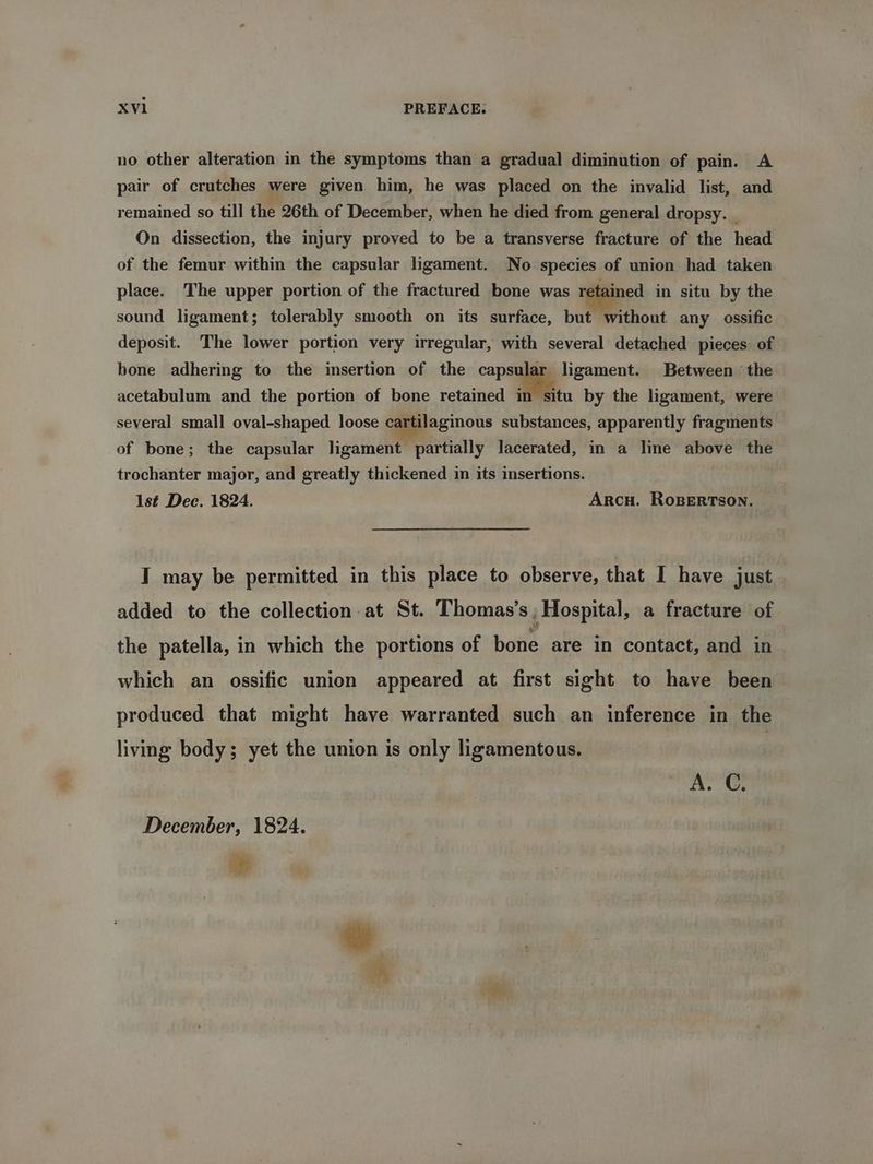no other alteration in the symptoms than a gradual diminution of pain. A pair of crutches were given him, he was placed on the invalid list, and remained so till the 26th of December, when he died from general dropsy. | On dissection, the injury proved to be a transverse fracture of the head of the femur within the capsular ligament. No species of union had taken place. The upper portion of the fractured bone was retained in situ by the sound ligament; tolerably smooth on its surface, but without any ossific deposit. The lower portion very irregular, with several detached pieces of bone adhering to the insertion of the oa ligament. Between ‘the acetabulum and the portion of bone retained i several small oval-shaped loose cartilaginous substances, apparently fragments situ by the ligament, were of bone; the capsular ligament partially lacerated, in a line above the trochanter major, and greatly thickened in its insertions. 1st Dee. 1824. ArcH. RoBERTSON. I may be permitted in this place to observe, that I have just added to the collection at St. Thomas’s _ Hospital, a fracture of the patella, in which the portions of botie are in contact, and in which an ossific union appeared at first sight to have been produced that might have warranted such an inference in the living body; yet the union is only ligamentous. A. C. December, 1824.