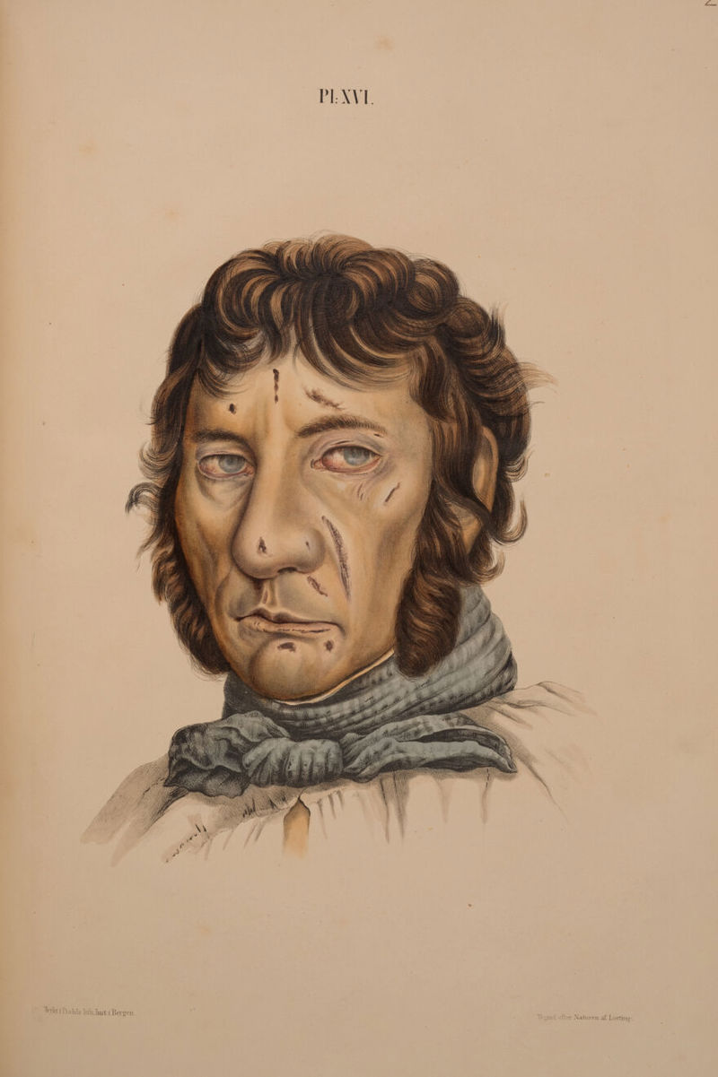 No text description is available for this image