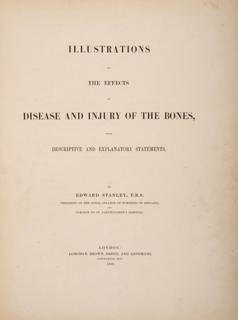 ILLUSTRATIONS THE EFFECTS OF DISEASE AND INJURY OF THE BONES, DESCRIPTIVE AND EXPLANATORY STATEMENTS. BY EDWARD STANLEY, F.R.S. PRESIDENT OF THE ROYAL COLLEGE OF SURGEONS OF ENGLAND, AND SURGEON TO ST. BARTHOLOMEW’'S HOSPITAL. LONDON: | LONGMAN, BROWN, GREEN, AND LONGMANS, PATERNOSTER ROW. 1849.
