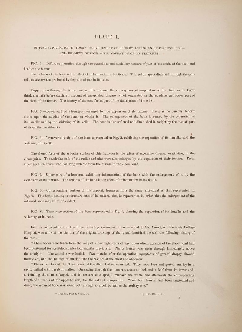 PLATE. f. DIFFUSE. SUPPURATION IN BONE*—ENLARGEMENT OF BONE BY EXPANSION OF ITS TEXTURE +— ENLARGEMENT OF BONE WITH INDURATION OF ITS TEXTURE}F. FIG. 1.—Diffuse suppuration through the cancellous and medullary texture of part of the shaft, of the neck and head of the femur. | The redness of the bone is the effect of inflammation in its tissue. The yellow spots dispersed through the can- cellous texture are produced by deposits of pus in its cells. Suppuration through the femur was in this instance the consequence of amputation of the thigh in its lower third, a month before death, on account of encephaloid disease, which originated in the condyles and lower part of the shaft of the femur. The history of the case forms part of the description of Plate 18. FIG. 2.—Lower part of a humerus, enlarged by the expansion of its texture. There is no osseous deposit either upon the outside of the bone, or within it. The enlargement of the bone is caused by the separation of its lamella and by the widening of its cells. The bone is also softened and diminished in weight by the loss of part of its earthy constituents. 3 FIG. 3.—Transverse section of the bone represented in Fig. 2, exhibiting the separation of its lamella and the widening of its cells. The altered form of the articular surface of this humerus is the effect of ulcerative disease, originating in the elbow joint. The articular ends of the radius and ulna were also enlarged by the expansion of their texture. From a boy aged ten years, who had long suffered from the disease in the elbow joint. FIG. 4.—Upper part of a humerus, exhibiting inflammation of the bone with the enlargement of it by the expansion of its texture. The redness of the bone is the effect of inflammation in its tissue. FIG. 5.—Corresponding portion of the opposite humerus from the same individual as that represented in Fig. 4. This bone, healthy in structure, and of its natural size, is represented in order that the enlargement of the inflamed bone may be made evident. FIG. 6.—Transverse section of the bone represented in Fig. 4, showing the separation of its lamellz and the widening of its cells. For the representation of the three preceding specimens, I am indebted to Mr. Arnott, of University College Hospital, who allowed me the use of the original drawings of them, and furnished. me with the following history of the case :— ‘“‘'These bones were taken from the body of a boy eight years of age, upon whom excision of the elbow joint had been performed for scrofulous caries four months previously. The os humeri was sawn through immediately above the condyles. The wound never healed. Two months after the operation, symptoms of general dropsy showed themselves, and the lad died of effusion into the cavities of the chest and abdomen. ‘The extremities of the three bones at the elbow had never united. They were bare and grated, and lay in a cavity bathed with purulent matter. On sawing through the humerus, about an inch and a half from its lower end, and finding the shaft enlarged, and its texture developed, I removed the whole, and afterwards the corresponding length of humerus of the opposite side, for the sake of comparison. When both humeri had been macerated and dried, the inflamed bone was found not to weigh so much by half as the healthy one.”’