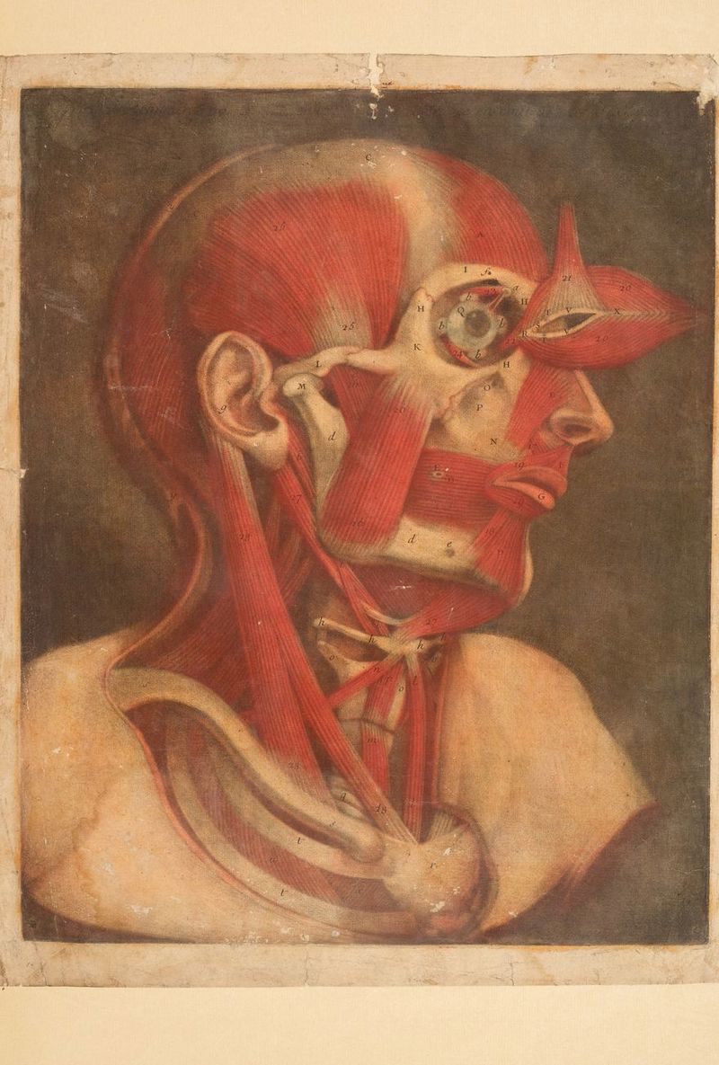 No text description is available for this image