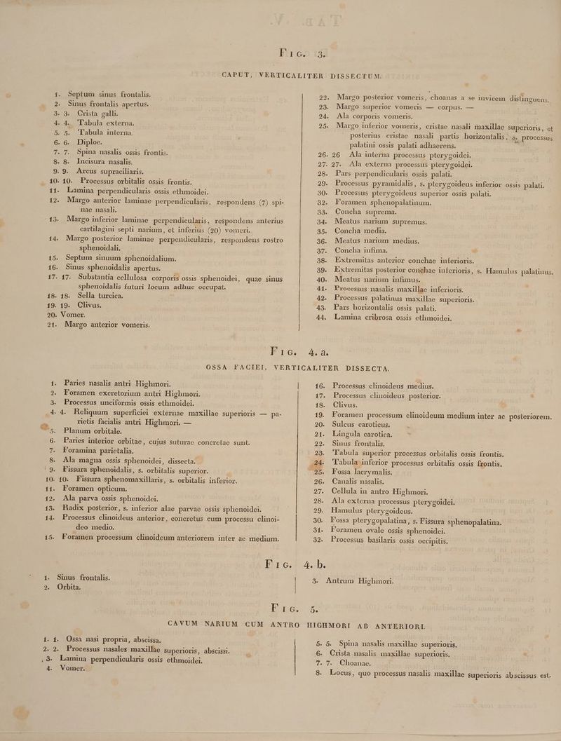 Etre 153: CAPUT, VERTICALITER DISSECTUM. í. Septum sinus frontalis. 22. Margo posterior vomeris, choanas a se invicein distinguens. 2. Sinus frontalis apertus. 23. Margo superior vomeris — corpus. — | S 9 Crnsta gall. | 24. Ala corporis vomeris. 4. 4. 'labula externa. | 25. Mlargo inferior vomeris, cristae nasali maxillae superioris, et - 5. 5. 'l'abula interna. i posterius cristae masali partis horizontalis, s. processus 6.-6G«... Diploe. palatini ossis palati adhaerens. | 7. 7. Spina nasalis ossis frontis. 26. 26 Ala interna processus pterygoidei. 8. 8. Incisura nasalis. 27. 27. Ala externa processus pterygoidei. 9. 9. Arcus supraciliaris. 28. Pars perpendicularis ossis palat. 10. 10. Processus orbitalis ossis frontis. 29. Processus pyramidalis, s. pterygoideus inferior ossis palati. 11. Lamina perpendicularis ossis ethmoidei. 30. Processus pterygoideus superior ossis palati. 12. Mlrgo anterior laminae perpendicularis, respondens (7) spi- 32. Foramen sphenopalatinum. nae nasali. 33. Concha suprema. 13. Margo inferior laminae perpendicularis, respondens anterius 34. Mleatus narium supremus. cartilagini septi narium, et inferius (20) vomer. 35. Concha media. 14. Margo posterior laminae perpendicularis, respondens rostro | 36. Mleatus narium medius. sphenoi1dali. 37. Concha infima. 15. Septum smuum sphenoidalium. 38. Extremitas anterior conchae inferioris. 16. Sinus sphenoidalis apertus. 39. Extremitas posterior conchae inferioris, s. Hamulus palaunus. 17. 17. Substantia cellulosa corporis ossis sphenoidei, quae sinus 40. Mleatus narium infimus. sphenoidalis futuri locum adhuc occupat. 41. Processus nasalis maxillae inferioris. 18. 18. Sella turcica. : 42. Processus palatinus maxillae superioris. 19. 19. Clivus. | 43. Pars horizontalis ossis palati. 20. Vomer. 44. Lamina cribrosa ossis ethmoidei. 21. Margo anterior vomeris. | * IIO xu OSSA FACIEI, VERTICALITER DISSECTA. 1. Paris nasalis antri Highmori. | 16. Processus clinoideus medius. 2. Foramen excretorium antri Highmori. | 17. Processus clinoideus posterior. 3. Processus unciformis ossis ethmoidei. | 18. Clivus. 4. 4. Heliquum superficiei externae maxillae superioris — pa. 19. Foramen processum clinoideum medium inter ac posteriorem. » rielis facialis antri Highmori. — 20. Sulcus caroticus. ut -5. Planum orbitale. 21. Langula carotica. 6. Paries interior orbitae, cujus suturae concretae sunt. 22. Sinus frontalis. | 7. Foramina parietalia. 23. 'l'abula superior processus orbitalis ossis frontis. S. Ala magna OSSIS sphenoidei, dissecta. à 24. 'labula inferior processus orbitalis ossis frontis. | 9. Fissura sphenoidalis, s. orbitalis superior. .25. Fossa lacrymalis. 10. 10. Fissura sphenomaxillaris, s. orbitalis inferior. 26. Canalis nasalis. ! 11. Foramen opticum.: 27. Cellula in antro Highmori. 12. Ala parva ossis sphenoidei. 28. Ala externa processus pterygoidei. 13. Hadix posterior, s. inferior alae parvae ossis sphenoidei. : 29. Hamulus pterygoideus. 14. Processus chnoideus anterior, concretus cum processu clinoi- 30. Fossa pterygopalatina, s. Fissura sphenopalatina. deo medio. 31. Foramen ovale ossis sphenoidei. 15. Foramen processum clinoideum anteriorem inter ac medium. 32. Processus basilaris ossis occipitis. I 6T 4h. 1. Sinus frontalis. | 3. Antrum Highmorr. 2. QOrbita. | Pues CAVUM NARIUM CUM ANTRO HIGHMORI AB ANTERIORTIE. 1. 1. Ossa nasi propria, abscissa. | 5. 5. Spina nasalis maxillae superioris. 2. 2. Processus nasales maxillae superioris, abscissi. 6. Crista nasalis maxillae superioris. ,9. Lamina perpendicularis ossis ethmoidei. | 7. 7. Choanae.