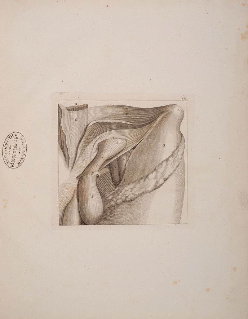 SINN NSS y \ N N N TÜNUNNANNNUN SIIINIRÄNRLRULN {N TRRRUNTHNNNNN UNNÄÄRRRERRRRNNUN NN NUN \ NN IRRRRÜRNURRUNR N TRRRRRRRRRNNNÜRRUNR \ INRRÄNILRRÄRRRRRRRRNU NR RUN INNE RRRRRRROR ZEN NNNNNNNNANNNRNANN ZEIT NUNRR N ( \ \ \ N \ AM) \ \ a INT NLINELLLIEN \ = NN \\\ N \ RN \TTTTTESTNLUINU ALIEN \NA Set N \ N IN um As N : S III IN N x N E\7