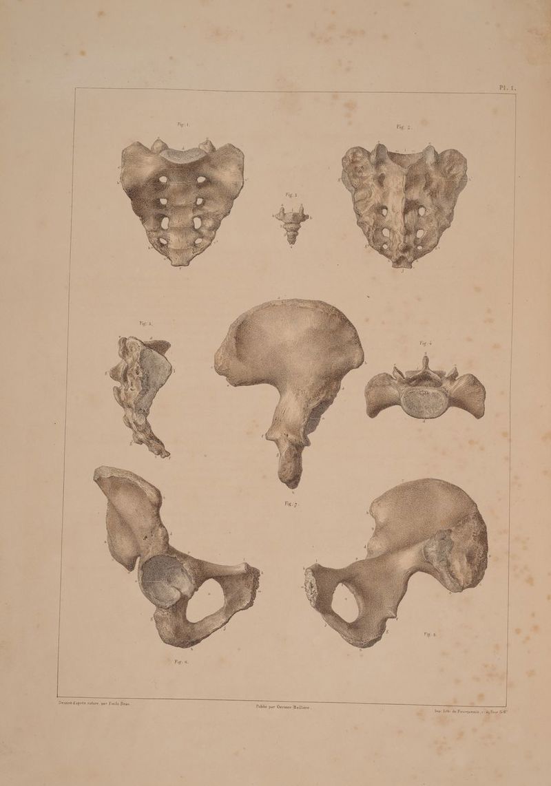 Pl. 1. ~ eus du Four Se@ de. Fourquemin , Imp: Lith 1€re . cane Publié par Germer- Baill ‘ ) dapres nature, par Fimile Beau. Z ssiné De a