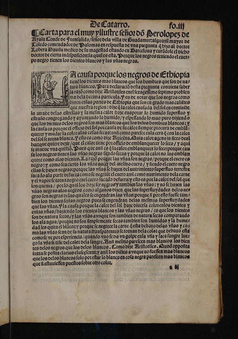 an PP sare Ss .. DelLatarro, fo.ííf qj cartapara elmuppliuitrefeño:00 fberolopes oe Z1yala fonde oc $uenfalída/fefiozoela villa oe fouadamur:alguasil mayo? de Toledo comendadozoc Palomas en rcfpuefta ve vna pregunta ¿bisoal voctoz Zobera Davila medico de fu mageltad eftando en Barcelona y curádole el vicho po negro tienen los dientes blancos y las víasnegras, 1 21 caufapoxguelos negros oe Ethiopia vías negrasalos negros como algunos dizen que lae fuperfiuydades oclosnes gros fon negras oclae quales feengendran las vías:pozquesí por efto fucfic tama bien los dientes ferian negros puesfeengendran delas meftmae fuperfluydades quclae vías.Pla caufa porque la caloz vel fol baze vincría.colorenlos dientes y enlas vfíae/bastcndo loe dientes blancos ylas vías negras / ce quelos dientes fondenatura fccoo/y lae vías avique fon tambien ve natura fecae comparando los ala agua /pozquenofon implemente fccae tambien fon bumídae y la Dumes dad les quíta el blácoz:y porque fe negrecela carne q efta ocbaxo velas vías y coz molas vías fcau oc funaturafranfpsrentes fetoznan dela colo? que ocbaxo efta comofe ve pozefperíencía / quando vio fcoa vn golpe enla vía y faca fangre luez go la yñaferiñe vel colo: ocla fangre, Zinn memo parefcer mae blancos los dien tes velos negros que loe ocloe blancos , omo oíse Zlriftoriles, auod oppofita iuxta fc pofita clariueclufcefcunt;y anfi loe olétes aviiqueno faeffen mas blancos quelosoclosblancosfolopozeftarlo blanco en cofa negra parcícen mas blancos quei cftuuicffen pueltosfobzc otro colos, dd