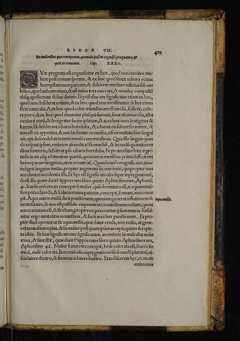Yi my jut Xy LIBER VH. De ulicribut que coticeperunt, quomodo pofiint cognofci pvegnantes, e quid eis conueniat, Cap. XXXy, Vx pregnata efLcognofcitur ex hoc , quod noncurritex mti J| lierepoft coitum fperma, &amp; ex hoc quod fentit inhora coitus bu) horripilationemparuam,&amp; dolorem medium inferius füb umi erm pud uuluametiam,&amp; eft uulua tota exiccata,( os uulue compactü abfq; apoftemate &amp; fine duritie. Ft poftiflas res fi gnificatur etiam ex hoc, quod non defiderat coitum, &amp; ex hoc quod non SEsiusindt in hora men flrui naturalis, &amp; ex hoc quod color mátmillarumeft uiridis, fcilicet; colo» reporri,&amp;ex hocquod eleuantur pluíqua fuerunt, fiunt etramuiridia;alba oculorü eorü,&amp;denigratur facies ipfarum,&amp; accidunt in eis lentiomnes &amp; barras.Etdefiderant cibaria horribilia , &amp; aduenit eis fübuerfio animx, &amp; noneft eis appetitus, non lzeduntur ex naufea,nifi ex multitudine fangui nis,qui defcendebat inomni menfe cummenflruis, Quíaifle fanoguis quan dorefpuitipfum, embrion afcenditad flomachü , &amp; fecundü quantitatem illius humoris,dehideratipfa cibarra horribilia. Et protenditur hec vort^ tudoijn eis uíg ad menfem quartüi,quoniamin menfibus primis fufficite em brioni parum fanpuinis;ut ex eonutriat, Quando uero y magnifi catur,tunc indiget fanguine Inslto propter augmentü fui nutríméti quapropter nori accidunt eiaccidentia ifta, Ft hec efti ignifi catio alia fuper inpreenationé, &amp;eftilla quam dixitFippocrates libro quinto Aphorifmorum, Aphorif. 43.Siuelis nofcerean conceperit mulier ,quü dormitura eft,eraquammul fam potandamda, &amp; fi alui tormina patietur ,concepit,fi minus, non concé nentofitates,&amp; non eftpoflibile eis penetrare idein íedan ,quoni amcoartatum eft firictum;pro ptereaquiacoartat ipfum matrix. Refol^ uitur ergo uentofitas inintefunis , &amp; facit accidere punctionem. Et pro« pter illud oportet ut fit aqua mellis;quae datur cruda, non cocta, ut gene- retuentofitates plus, fit mulier poftquam iplamaccepit;quieta &amp; reple- tacibis, Etfunt fienificationes fignificantes, an embrio fit mafculus anfce mina, &amp; funt ille; , quas dixit Fhippocrates libro quinto Aphorifmorum, Aphorifmo 42. Mulier fimarem concepit, bene colorata eflfiuero fce mina, male colorata, Et ex maículis inpreonatio nofit fecundu plurimü,ni- funlatere dextro, &amp; E inlatere Foitto. Ettudilcernis hec,ex motu embrionis A