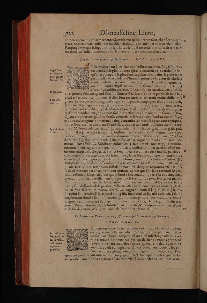 Er . CRETE AT min ler ri EEE nee Et parrait a Aie 722 Dixneuñiefme Liure, tiues, &amp; partant cfchauffent &amp; fubriliencle fang , le faifant fluer en la partie bleffée. Parquoyapres que la fuppuration fera faire, &amp; qu’il ne refte plus qu’à deterger &amp; incarnet, &amp;l’inflammation paffée, fera tres- vrile 8&amp;expédient d'en vfer. Des dartres on fciffures ferbigineufes. CHAP. XXXVI. —#> Efte maintenant à traiéter des fciflures ou creuafles , lefquelles furuiennent le plus fouuent apres la cutation de la verole. Le lieu ee qu'elles occupenrle plus, fontlespalmes des mains,&amp; plantes des # pieds. Elles font caufées d'humeur pituiteux falé ,ou de cholere renduë adufte par lintemperie chaude de la male fanguinaire, ou de quelque reliquat &amp; portion du ferment de ce virus, lequel eftenuoye aufdices parties. Or quanrà leur curation, elle eft diff- Quel lien octupent le à plus fouuent d des dartres. 2 Prognoflis. ee À 3 | SV cile, principalement quand elles foncinueterées, à caufe que les parties fe font ha- 4,408 bituées à receuoir cel humeur : Gelles fonc recentes, elles feront moins difficiles à B re aes PRESS à ie : À A , ; ; : der, guarir.Lesrecentes font cogneués par vie rougeur accompagnée d'vn grand prurit, &amp; le cuir eft plus gros, efpais , &amp; aride que de couftume: celles qui fontinueterées, outre les fignes predits, ily a des durecez fquameufes , &amp; furfureufes, de forte qu’en les frottantrudement, on en voit fortir des efcailles en maniere de farine de fon, Quanrà lacuration, pour les chofes vniuerfelles il faucauoir efgardau vice du foye, ordonnanticregime,purgations, bains, ventoufes, cornets. Étquantauxtopiques, ficelles fontrecentes, on vfera d'eau deficcatiue, &amp; de tenué fubftance ,comme cer- Remede pour C-CY. 22. Aquærofar, pariet.ah.3 j.aquæalum. 3 1j. chalcit. 5 ij. alum. 3 üij. pul. icelles. fublim. 5 1j. fat lenta &amp; minima ebullitio in balneo Mariæ. Onatiymentera la for- ce de celte eau par le fublimé , ou fera diminuée felon qu’il fera necéffaire, 3£. Olei de tartar, Z 1j. fapo. communis 3 ilij. mifce, &amp; fiat vnguentum ad vfum. Autre de merueilleux effet. 22. Sublimaci puluerifati 3 1j. aluminis rochæ 3 j. albumina ouorum fortiteragitatorum quantum fufficiat, applicetur fuper parcem affeétam: interim vtatur décoéto gaiaci. Sielles fontinuererées , il les faut ramollir par deco- “tionsemollientes ,attenuatiues &amp; incifiues , &amp; par linimens ,onguens, emplaftres demefme faculté : puis y proceder auec parfums , comme deceftuy qui fenfuit. 2£. Pul.cinab. 3 ij. labdani , affæ odorat. ftyrac. calamicæañ, 3 8. olibani, malt. añ. 3 iij. olcitart. &amp; rheriacæ quant. fuff. ant trochifci: defquelson pourra vfer, la do- fe de demiconce par chacune fois ou enuiron: &amp; faut que l’on face receuoir le par- fum feulement à la partie, fans que la fumée foit communiquée à la bouche, nez, yeux, où orcilles. Pareillement ce remede eft fort propre pour frocter les mains. Prenez cendre de grauelée, &amp; en faites capicel dans vne chauffe d’hippocras, &amp; en iceluy fautdiffoudre dela prefure, &amp; battreaflezlonguementen vn mortier, &amp; de ce en faur frotter les mains. Autre. 22. vnguenti enulati 3 ii). fugitiui 3 ÿj. re- finæ pini 3 j. ceruflæ 3 $..argenci viui 3 ütij. fucci cicri &amp; lapathi acuci añ. 3. in. corporencur {mul : fiat finimentum quo illiniatur pars. Si on y adioufte demie dragme defublimé,laué &amp; preparé comme celuy des fars, il fera de grande efficace. re . 2 » Autre. Prenez alumbruflé, &amp; fubtilement puluerifé,&amp; incorporé auec blanc d'œuf De la maladie V'enerienne, on graffe verole qui [uruient aux ptits enfans. CHAP. XXXV IL Ouueënt on veoit fortir Îles petits enfans hors le ventre de leur mére , ayans cefte maladie, toft apres auoir plufieurs puftu- les fur leurs corps : lefquels eftans ainfi infeétez, baillenc la ve- role à autant de nourrices qui les alaïétent : aucuns prennent la verole de leur nourrice : parce qu'icelle maladie, comme auons dit, eft contagieufe. Or on veoit peu fouuent les en- fans naizauecceftemaladie,receuoirguarifon:mais ceux qui l’ac- quierent par tetterquautrementefkans ja grandelets font quelquesfois guaris. Lé moyen de paruenir à la curation eft de faire vfer à la nourrice de l’eau theriacale. Lespetits en= fans nai? a mec la veroles difficilement reçotuen£ guarifon.
