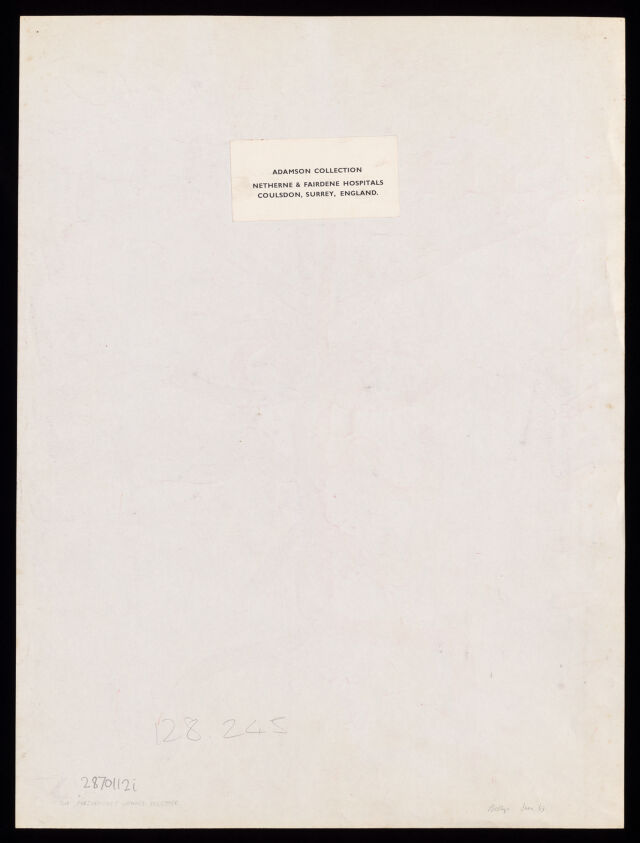 No text description is available for this image