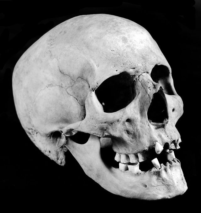 No text description is available for this image