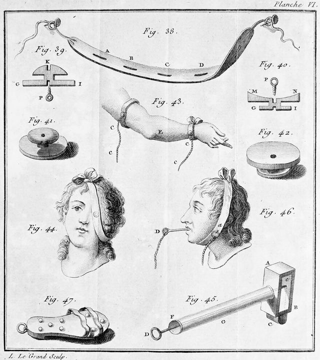 No text description is available for this image