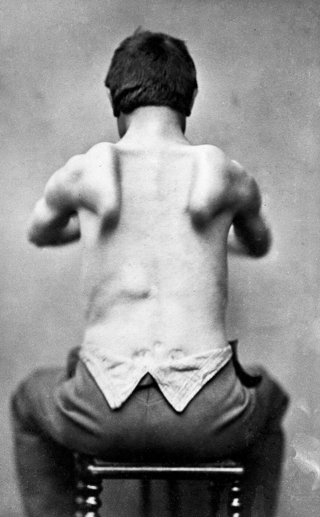 No text description is available for this image