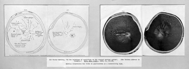 digitised image 1