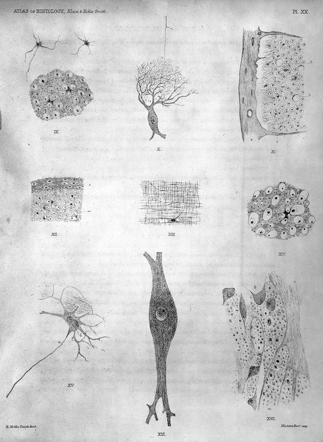 No text description is available for this image