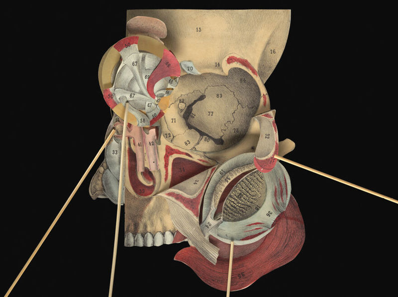 No text description is available for this image