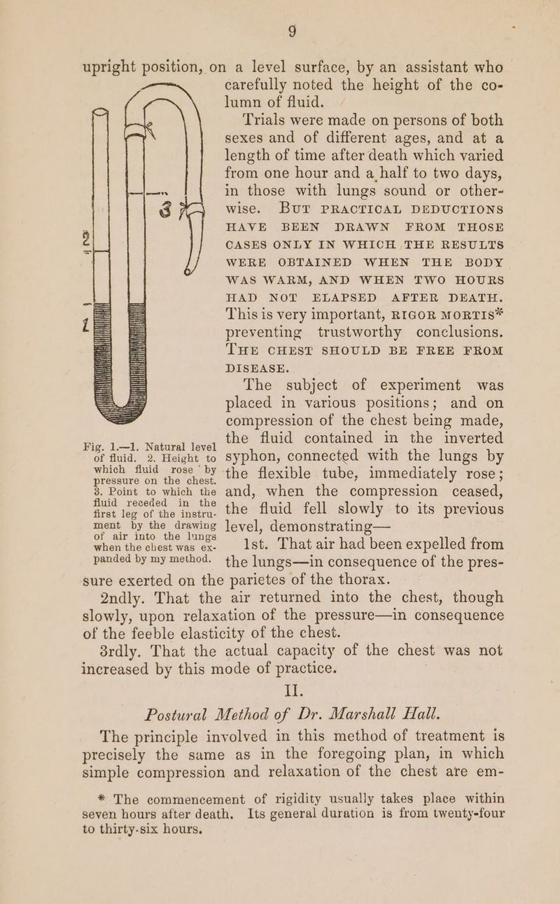 upright position, on a level surface, by an assistant who carefully noted the height of the co- lumn of fluid. Trials were made on persons of both sexes and of different ages, and at a length of time after death which varied from one hour and a_ half to two days, in those with lungs sound or other- wise. Bur PRACTICAL DEDUCTIONS HAVE BEEN DRAWN FROM THOSE CASES ONLY IN WHICH THE RESULTS WERE OBTAINED WHEN THE BODY WAS WARM, AND WHEN TWO HOURS HAD NOT ELAPSED AFTER DEATH. This is very important, RIGOR MORTIS* preventing trustworthy conclusions. THE CHEST SHOULD BE FREE FROM DISEASE. The subject of experiment was placed in various positions; and on compression of the chest being made, the fluid contained in the inverted syphon, connected with the lungs by iT IR im vit Nill} Fig. 1—1. Natural level of fluid. 2. Height to which fluid rose’ by pressure on the chest. 3. Point to which the fluid receded in the first leg of the instru- ment by the drawing of air into the lungs when the chest was ex- the flexible tube, immediately rose; and, when the compression ceased, the fluid fell slowly to its previous level, demonstrating— Ist. That air had been expelled from panded by my method. the lungs—in consequence of the pres- sure exerted on the parietes of the thorax. 2ndly. That the air returned into the chest, though slowly, upon relaxation of the pressure—in consequence of the feeble elasticity of the chest. 8rdly. That the actual capacity of the chest was not increased by this mode of practice. It, Postural Method of Dr. Marshall Halt. The principle involved in this method of treatment is precisely the same as in the foregoing plan, in which simple compression and relaxation of the chest are em- * The commencement of rigidity usually takes place within seven hours after death. Its general duration is from twenty-four to thirty-six hours.