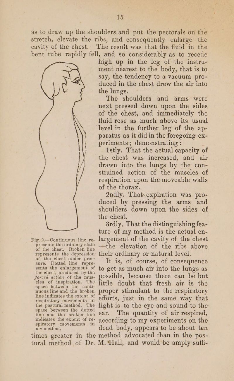 as to draw up the shoulders and put the pectorals on the stretch, elevate the ribs, and consequently enlarge the cavity of the chest. The result was that the fluid in the bent tube rapidly fell, and so considerably as to recede Fig. 2.—Continuous line re- presents the ordinary state of the chest. Broken line represents the depression of the chest under pres- sure. Dotted line repre- sents the enlargement of the chest, produced by the Jorced action of the mus- cles of inspiration. The space between the conti- nuous line and the broken line indicates the extent of respiratory movements in the postural method. The space between the dotted line and the broken line indicates the extent of re- spiratory movements in my method, high up in the leg of the instru- ment nearest to the body, that is to say, the tendency to a vacuum pro- duced in the chest drew the air into the lungs. The shoulders and arms were next pressed down upon the sides of the chest, and immediately the fluid rose as much above its usual level in the further leg of the ap- paratus as it did in the foregoing ex- periments; demonstrating : Istly. That the actual capacity of the chest was increased, and air drawn into the lungs by the con- strained action of the muscles of respiration upon the moveable walls of the thorax. ; 2ndly. That.expiration was pro- duced by pressing the arms and shoulders down upon the sides of the chest. 3rdly. That the distinguishing fea- ture of my method is the actual en- largement of the cavity of the chest —the elevation of the ribs above their ordinary or natural level. It is, of course, of consequence to get as much air into the lungs as possible, because there can be but little doubt that fresh air is the proper stimulant to the respiratory efforts, just in the same way that light is to the eye and sound to the ear. The quantity of air respired, according to my experiments on the dead body, appears to be about ten