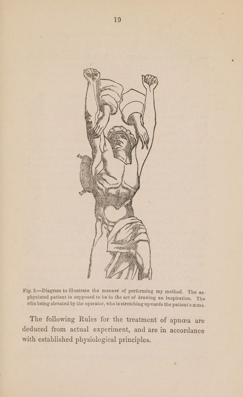 fei Bilt Hf yy dei! i } Now y a Of TB b y, i Fig. 5.—Diagram to illustrate the manner of performing my method. The as- phyxiated patient is supposed to be in the act of drawing an inspiration. The ribs being elevated by the operator, who is stretching upwards the patient’s arms. The following Rules for the treatment of apncea are deduced from actual experiment, and are in accordance with established physiological principles.
