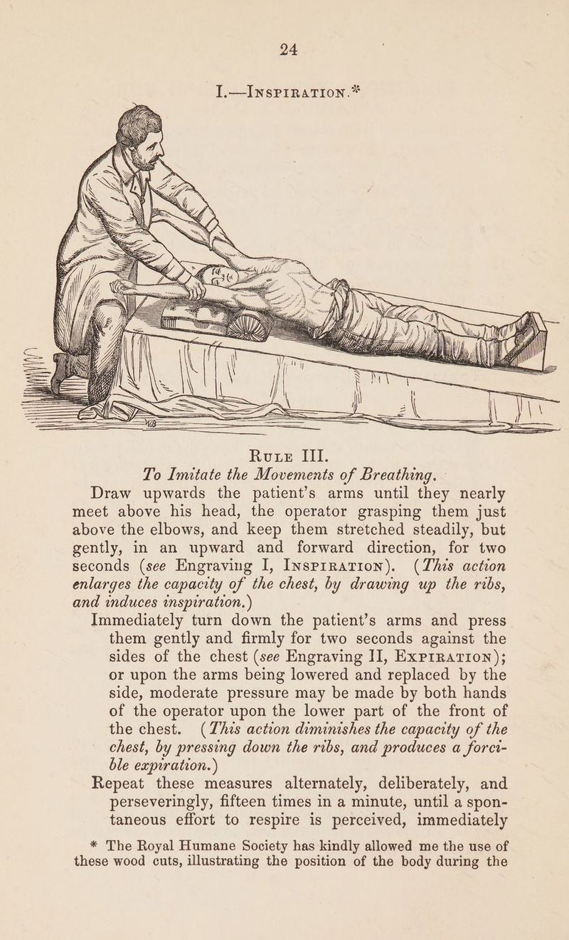 I.—INsPIRATION.* | pons ize Rote III. To Imitate the Movements of Breathing. Draw upwards the patient’s arms until they nearly meet above his head, the operator grasping them just above the elbows, and keep them stretched steadily, but gently, in an upward and forward direction, for two seconds (see Engraving I, Inspiration). (This action enlarges the capacity of the chest, by drawing up the ribs, and induces inspiration. ) Immediately turn down the patient’s arms and press them gently and firmly for two seconds against the sides of the chest (see Engraving II, Exprration); or upon the arms being lowered and replaced by the side, moderate pressure may be made by both hands of the operator upon the lower part of the front of the chest. (Zhis action diminishes the capacity of the chest, by pressing down the ribs, and produces a forci- ble expiration.) Repeat these measures alternately, deliberately, and perseveringly, fifteen times in a minute, until a spon- taneous effort to respire is perceived, immediately * The Royal Humane Society has kindly allowed me the use of these wood cuts, illustrating the position of the body during the