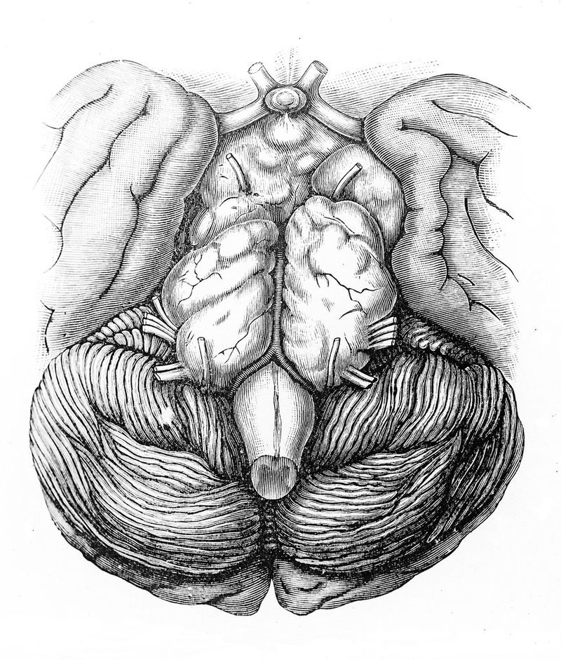 No text description is available for this image