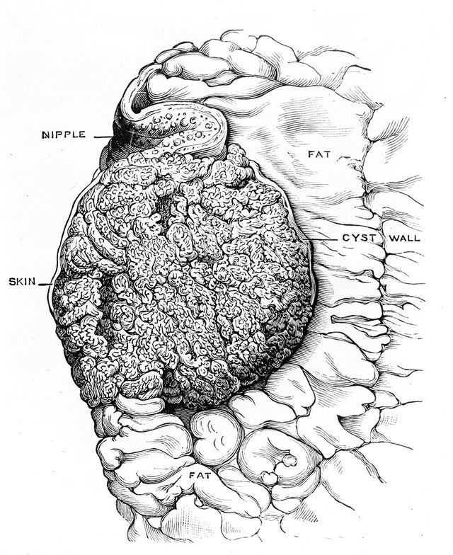 No text description is available for this image