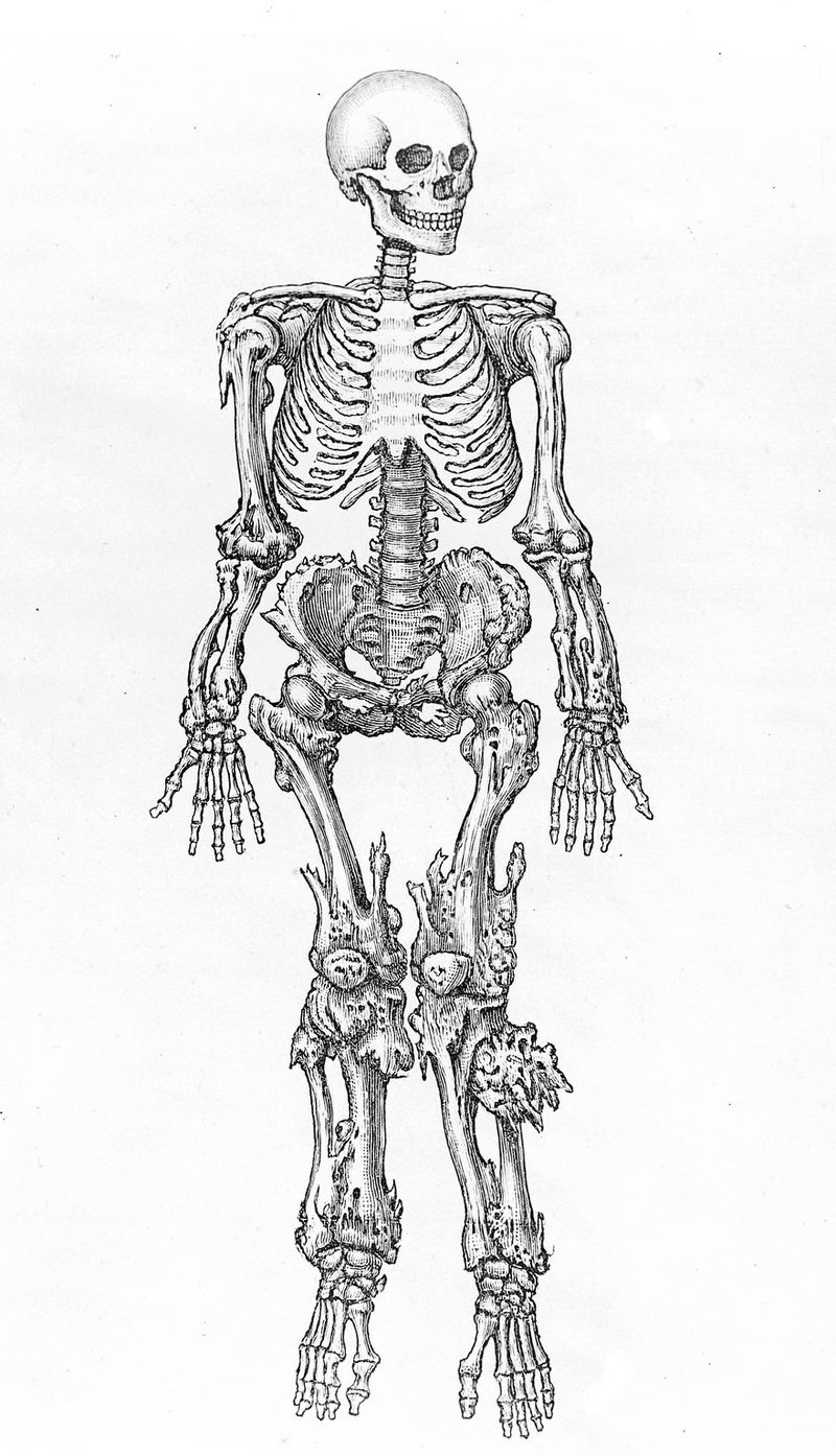 No text description is available for this image