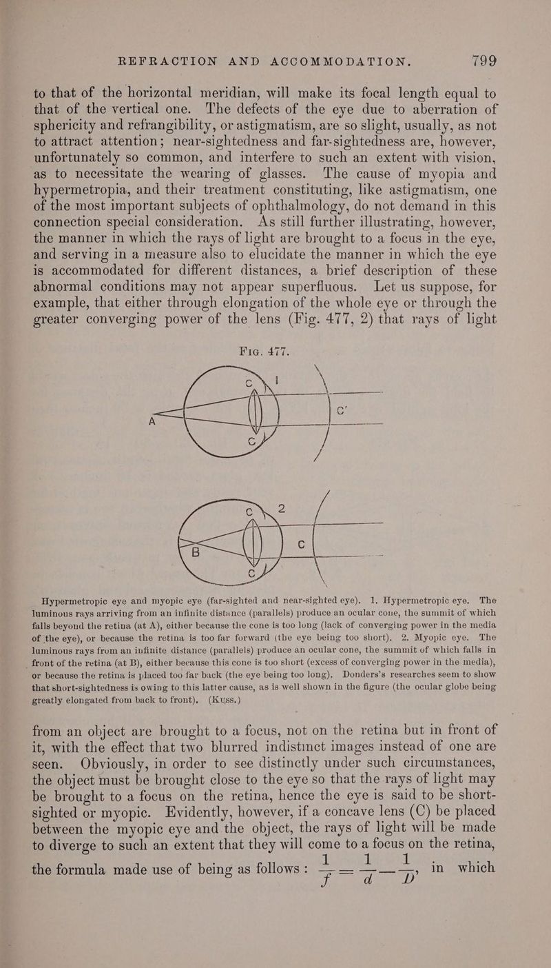 to that of the horizontal meridian, will make its focal length equal to that of the vertical one. The defects of the eye due to aberration of sphericity and refrangibility, or astigmatism, are so slight, usually, as not to attract attention; near-sightedness and far-sightedness are, however, unfortunately so common, and interfere to such an extent with vision, as to necessitate the wearing of glasses. The cause of myopia and hypermetropia, and their treatment constituting, like astigmatism, one of the most important subjects of ophthalmology, do not demand in this connection special consideration. As still further illustrating, however, the manner in which the rays of light are brought to a focus in the eye, and serving in a measure also to elucidate the manner in which the eye is accommodated for different distances, a brief description of these abnormal conditions may not appear superfluous. Let us suppose, for example, that either through elongation of the whole eye or through the oO greater converging power of the lens (Fig. 477, 2) that rays of light Hypermetropic eye and myopic eye (far-sighted and near-sighted eye), 1, Hypermetropic eye. The luminous rays arriving from an infinite distance (parallels) produce an ocular cone, the summit of which falls beyond the retina (at A), either because the cone is too long (lack of converging power in the media of the eye), or because the retina is too far forward (the eye being too short), 2. Myopic eye. The luminous rays from an infinite distance (parallels) produce an ocular cone, the summit of which falls in _ front of the retina (at B), either because this cone is tuo short (excess of converging power in the media), or because the retina is placed too far back (the eye being too long), Donders’s researches seem to show that short-sightedness is owing to this latter cause, as is well shown in the figure (the ocular globe being greatly elongated from back to front), (J uss.) from an object are brought to a focus, not on the retina but in front of it, with the effect that two blurred indistinct images instead of one are seen. Obviously, in order to see distinctly under such circumstances, the object must be brought close to the eye so that the rays of light may be brought to a focus on the retina, hence the eye is said to be short- sighted or myopic. Evidently, however, if a concave lens (C) be placed between the myopic eye and the object, the rays of light will be made to diverge to such an extent that they will come to a focus on the retina, the formula made use of being as follows : bhi? 1 feces in which